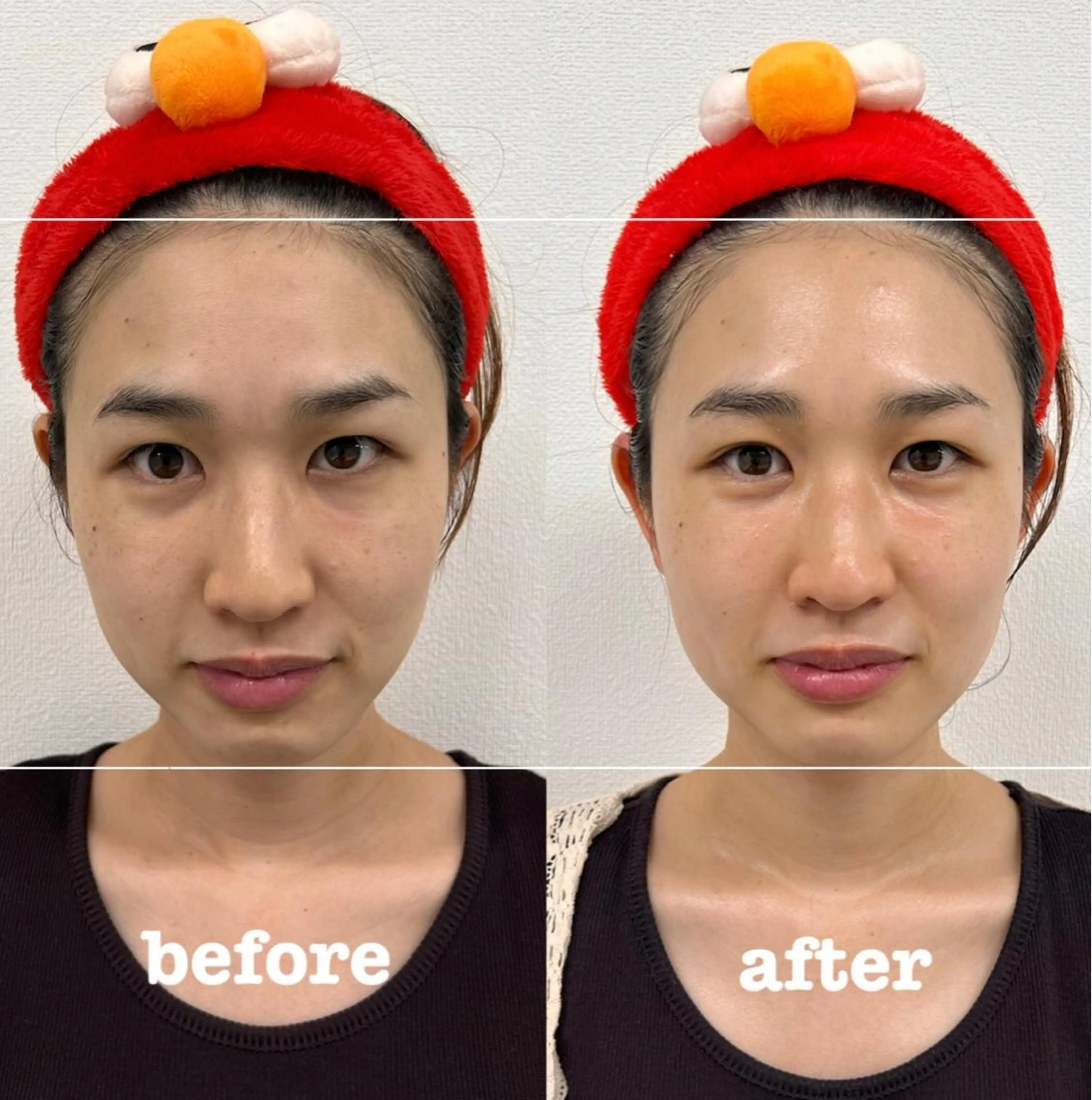 SUN&MOON REOのネイルデザイン