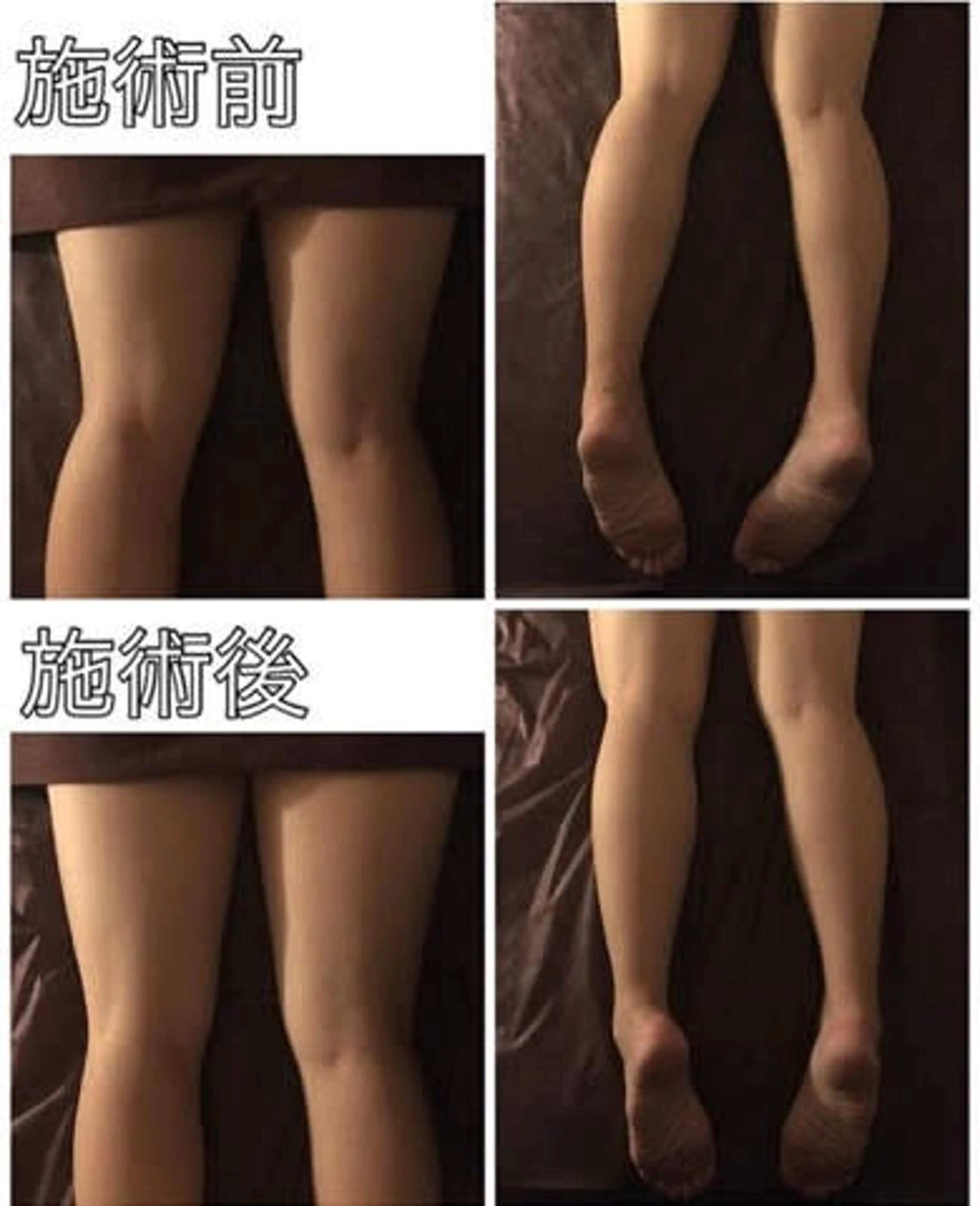 強圧デトックスリンパ 育菌専門店のその他イメージ