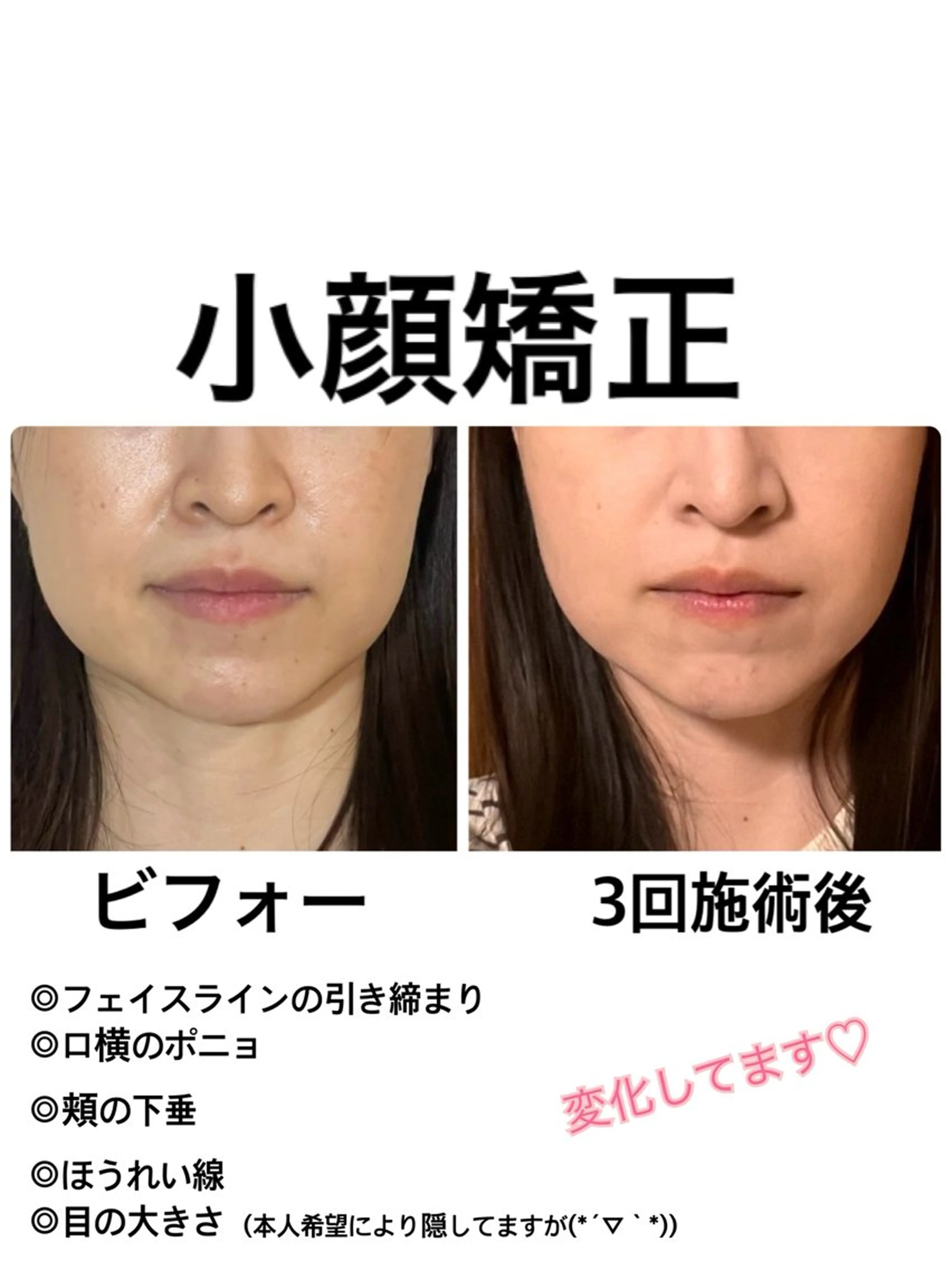 SINCERE MIYUKIのエステ・リラクイメージ