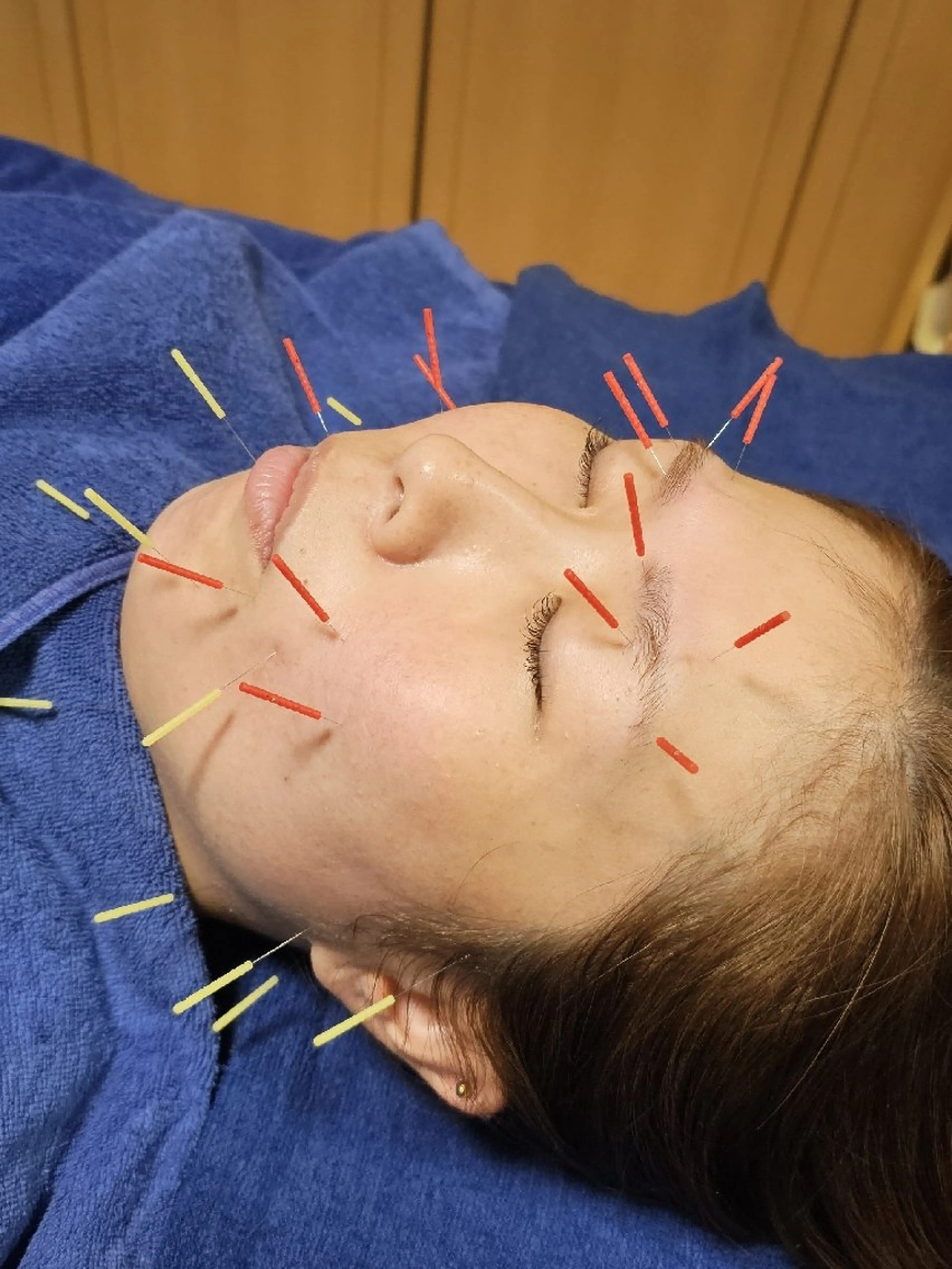 その他 鍼灸整体院アレンジ所属・鍼灸整体院 アレンジのその他イメージ