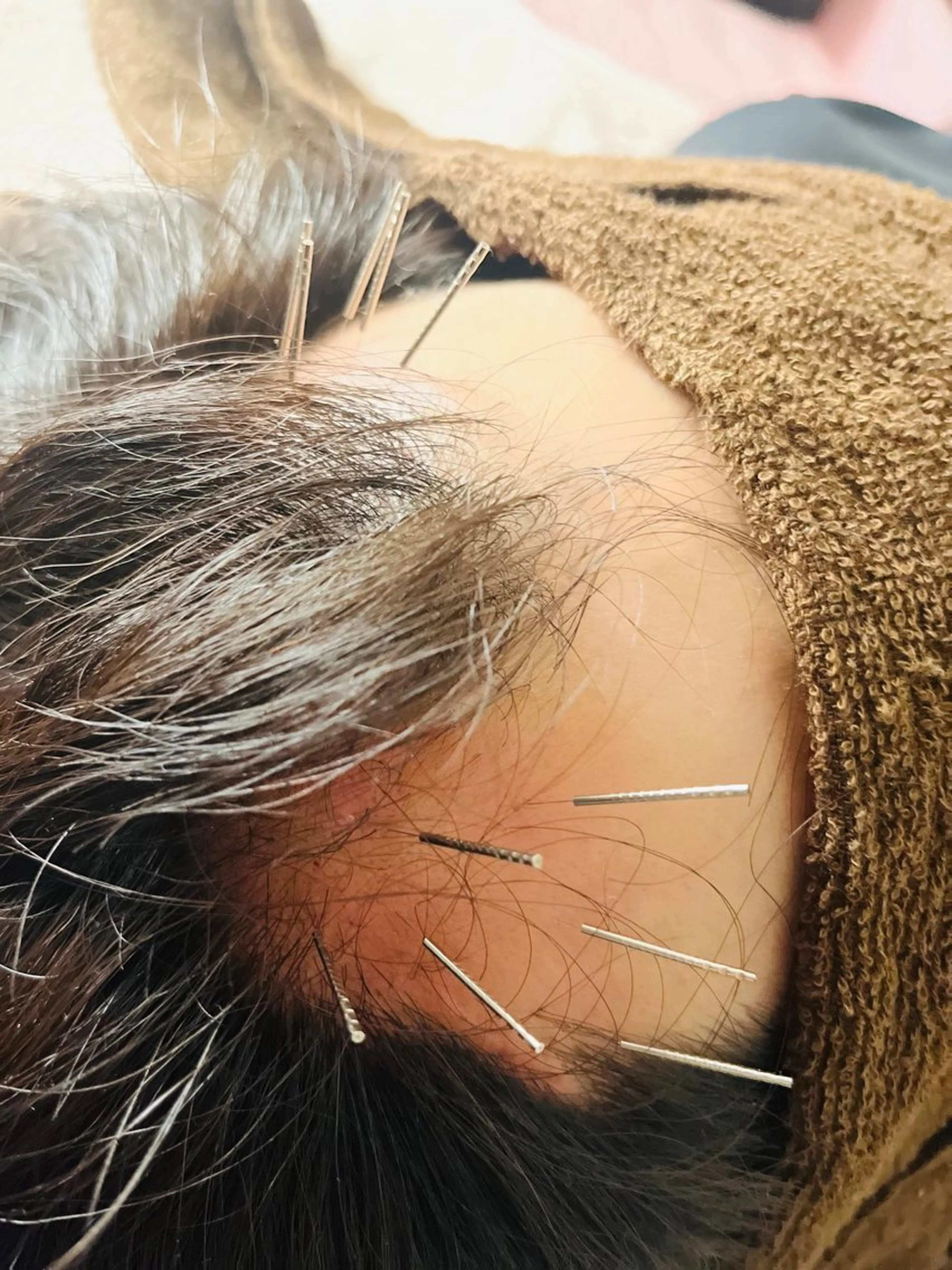 アロマ･美容鍼･カッ ピング「麗」鍼灸院のエステ・リラクイメージ