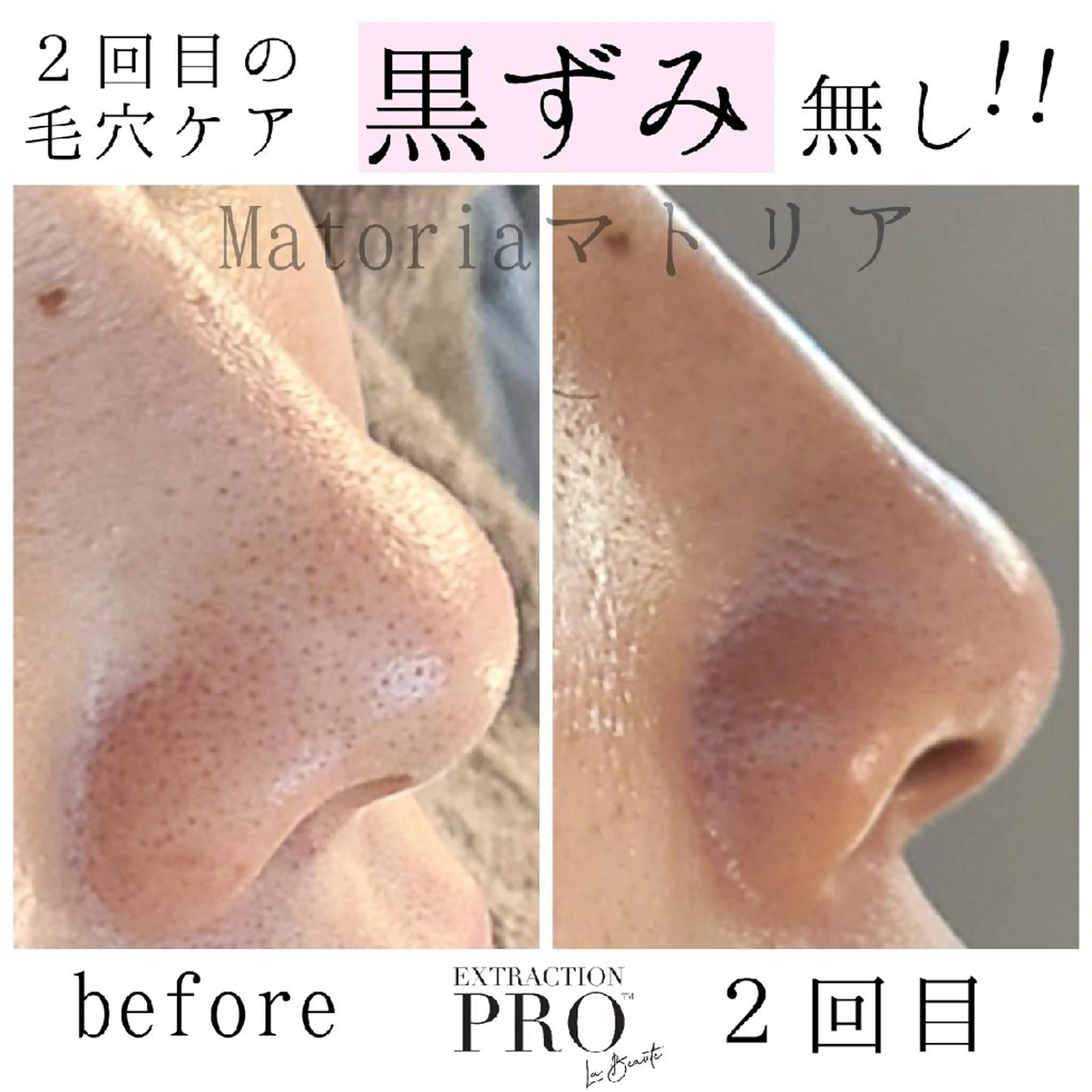 エステ 小顔 美肌専門 Matoriaのエステ・リラクイメージ