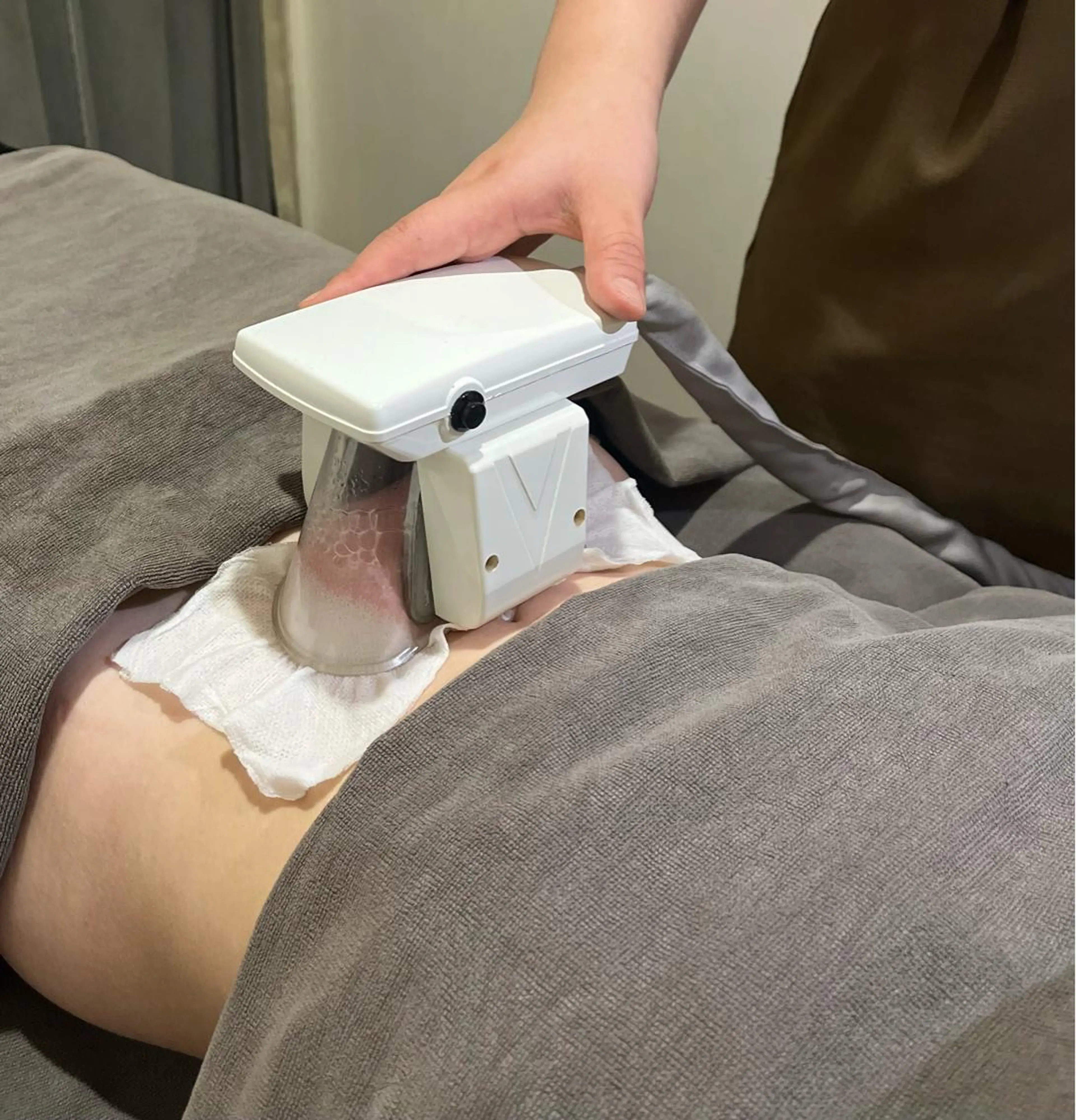 【 冷却痩身💙/クライオ１箇所✨️ 】(太もも､お腹､お尻､二の腕)寝てるだけで､減らない脂肪を集中攻撃🧊💙の写真