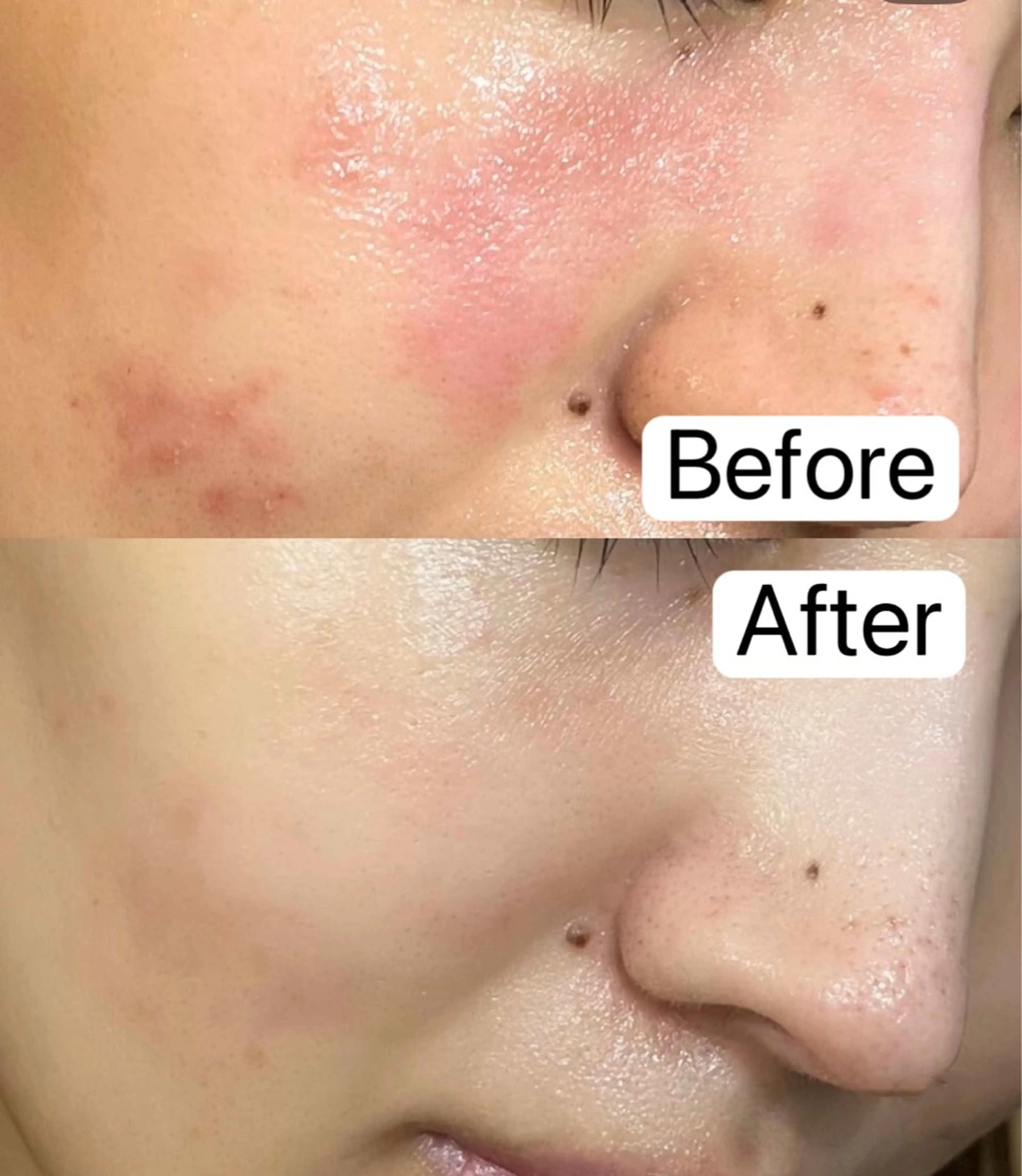 Belle原宿所属・佐藤 加奈のエステ・リラクイメージ