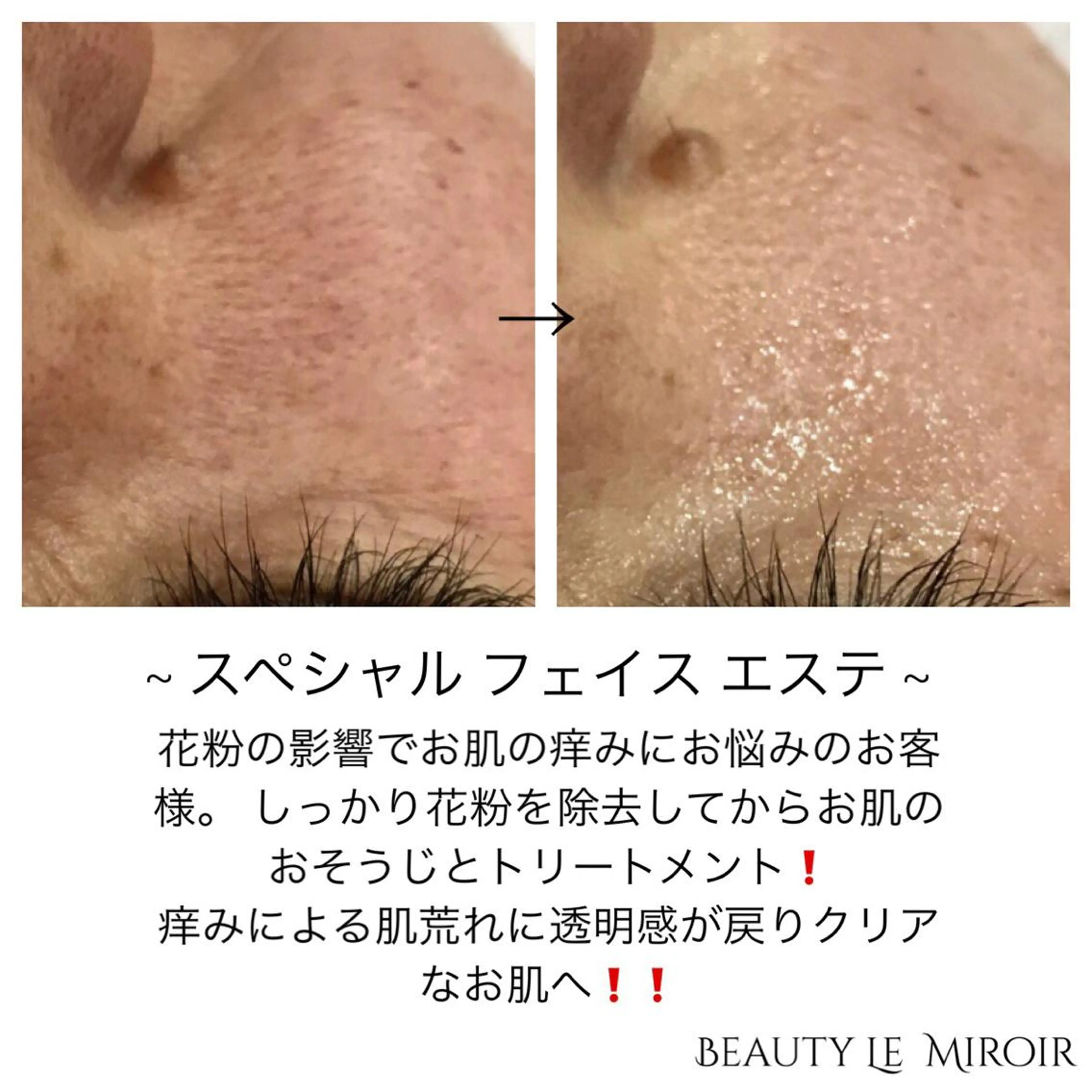 ビューティー ミロワールのエステ・リラクイメージ