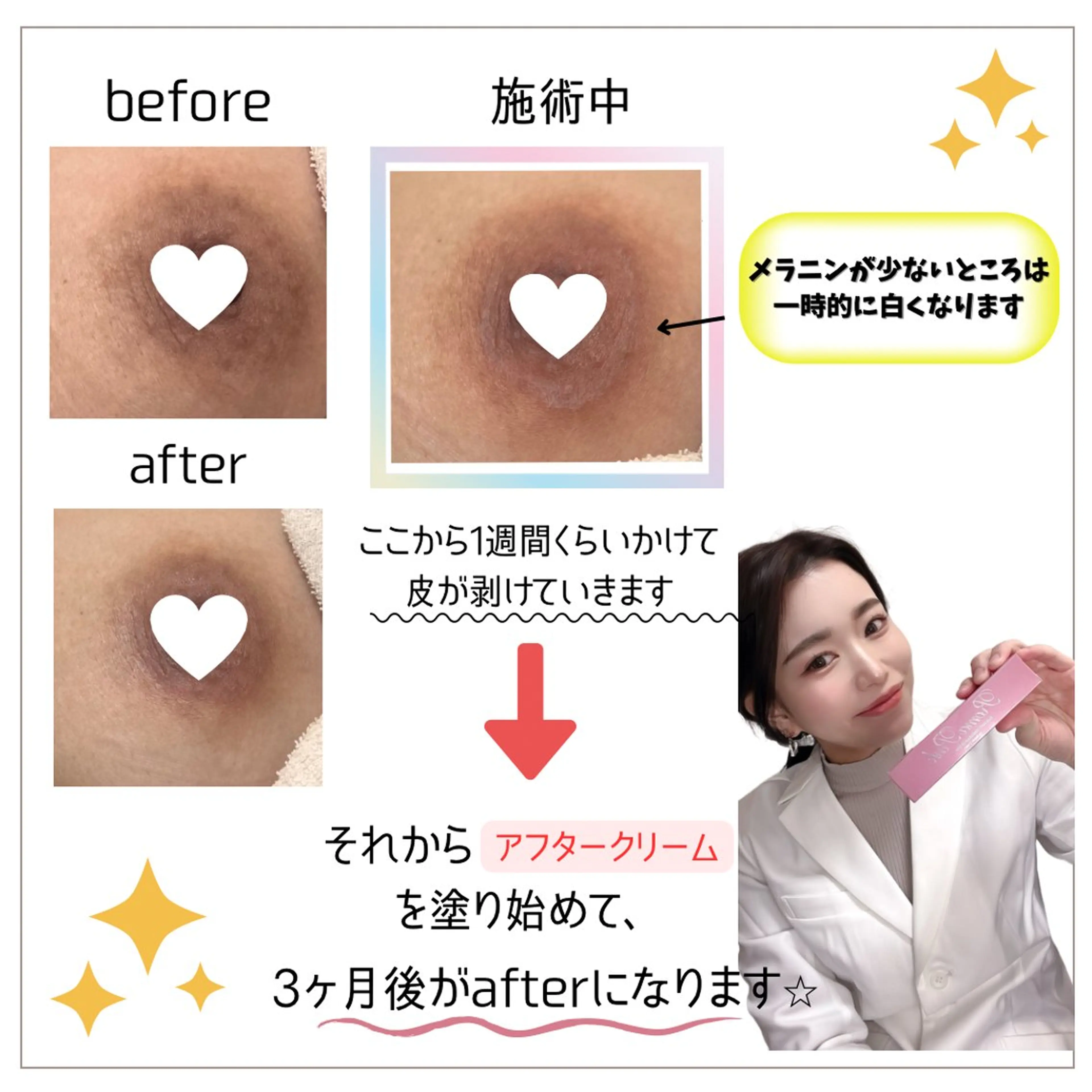 Raviy 【痩身・韓国肌管理】のエステ・リラクイメージ