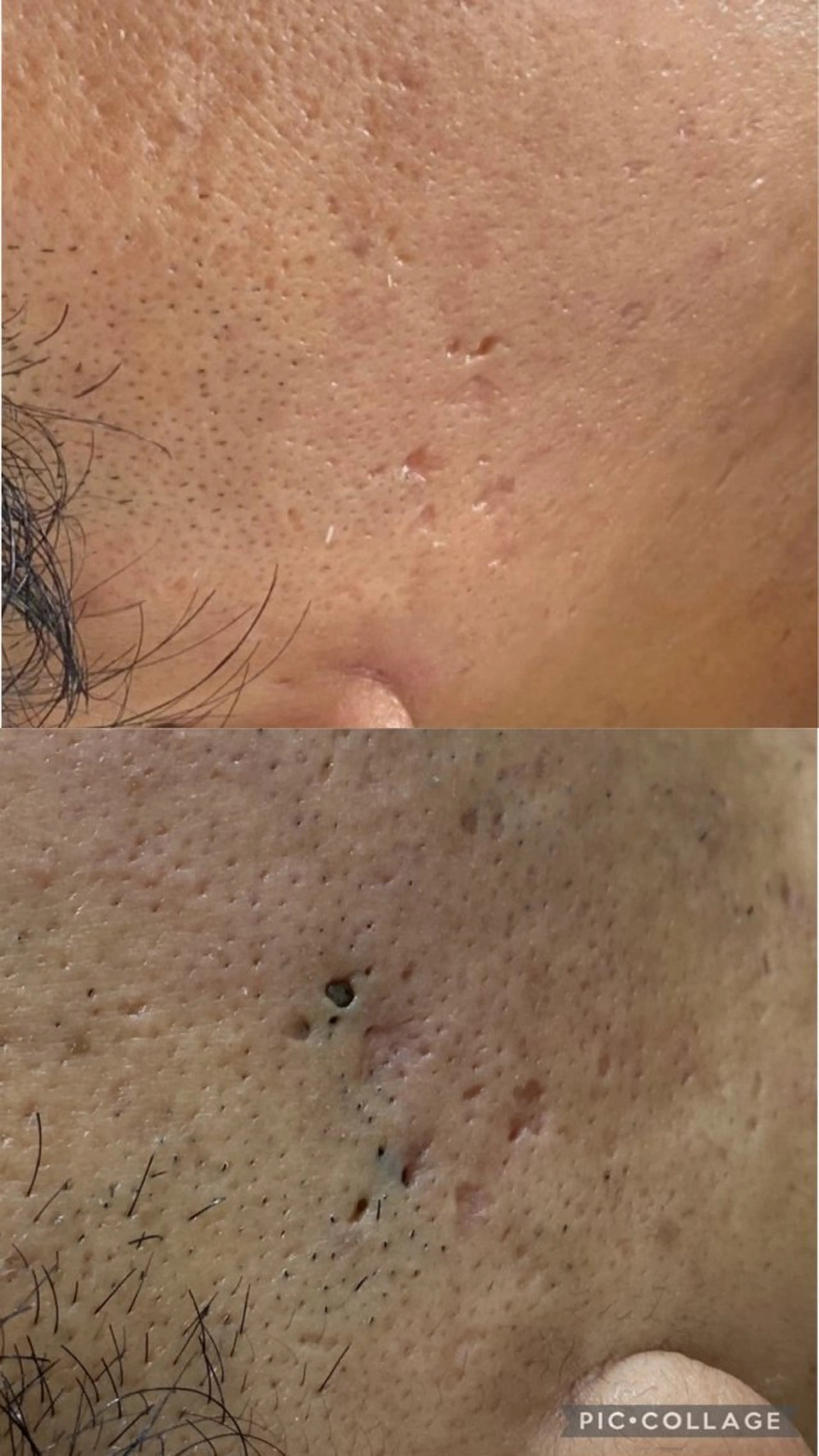 メンズ will 有希のネイルデザイン