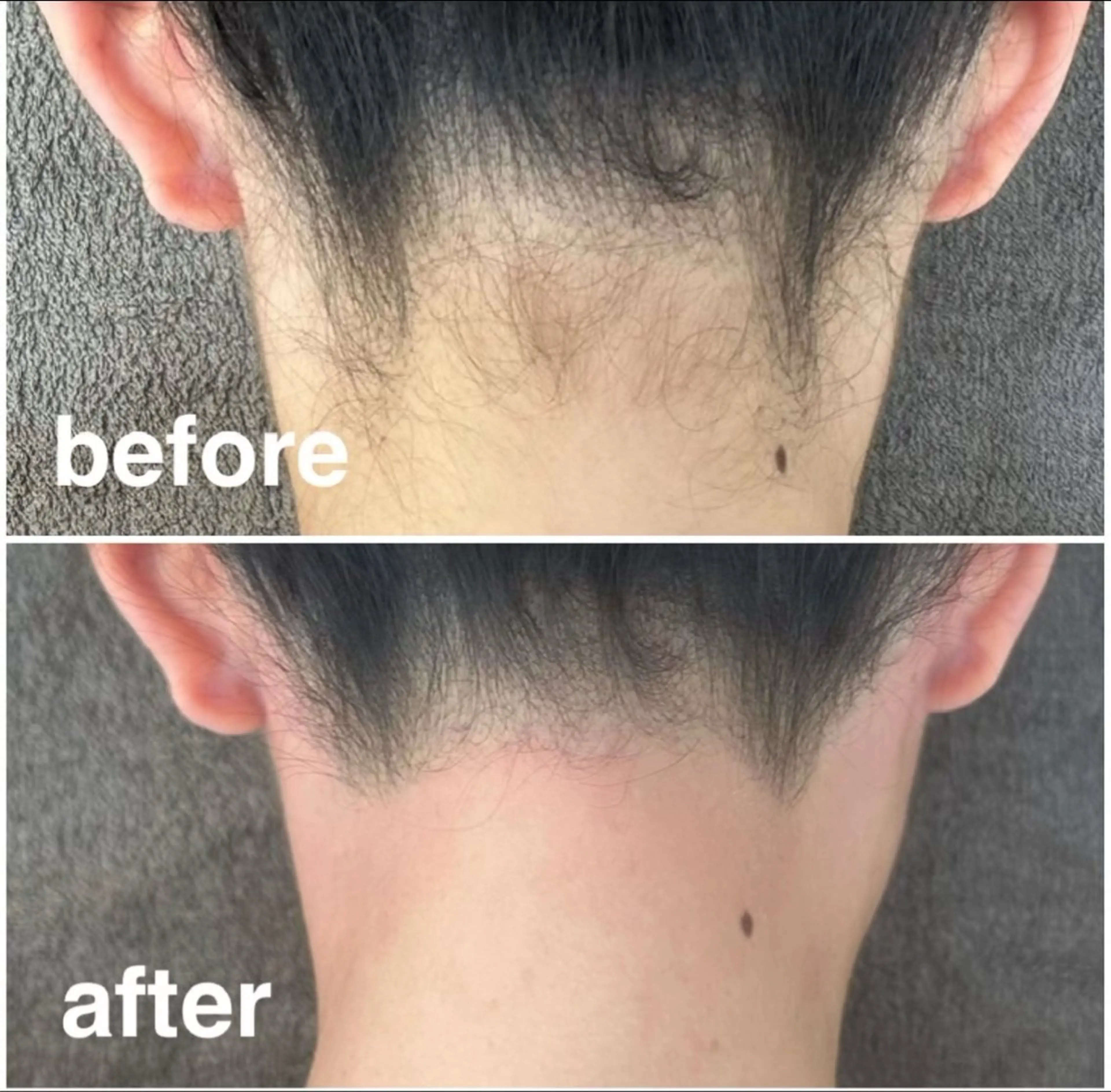 脱毛 foi sayaのエステ・リラクイメージ