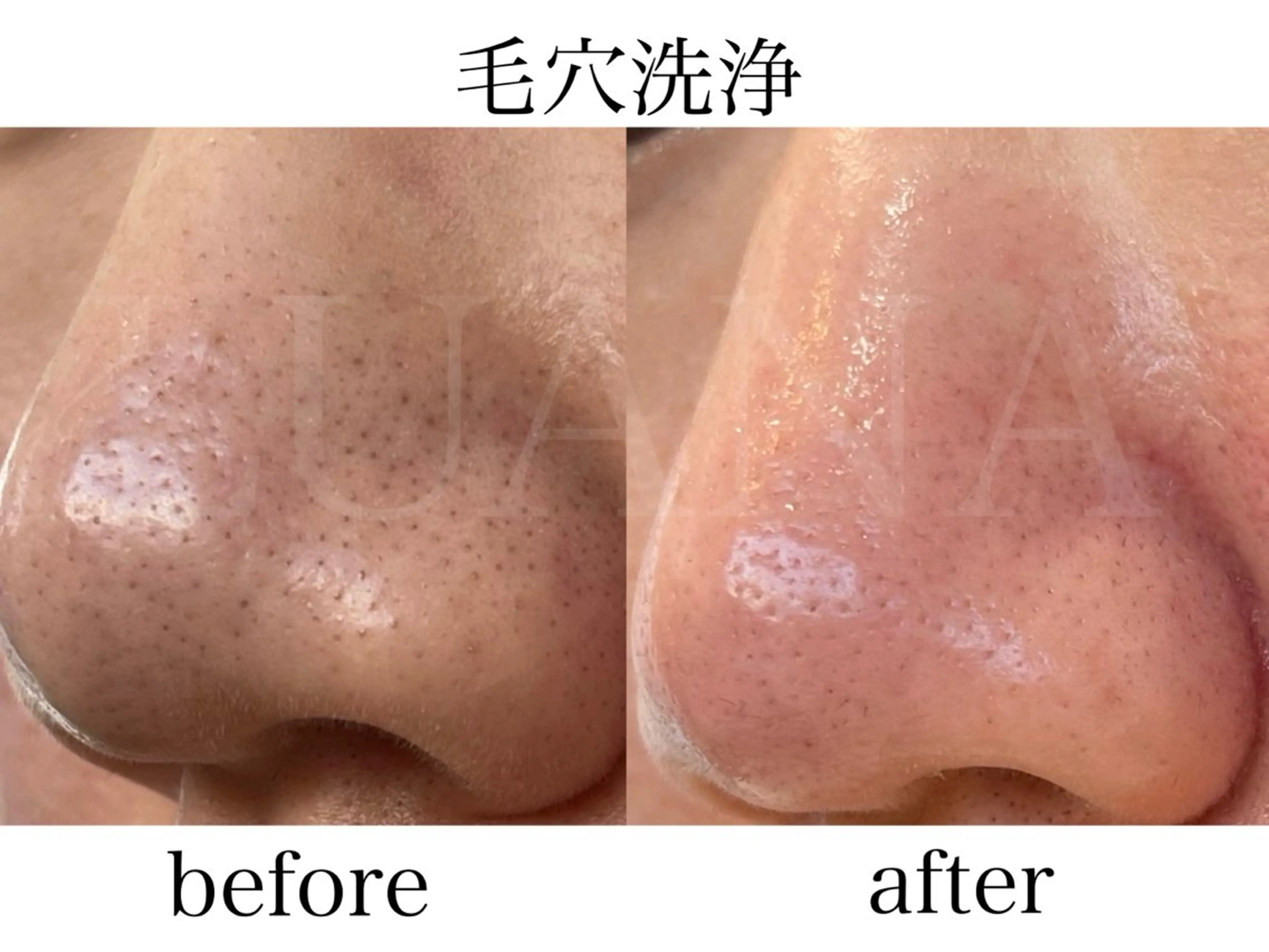 エステ LUANA TAKAGIの眉毛・アイブロウイメージ