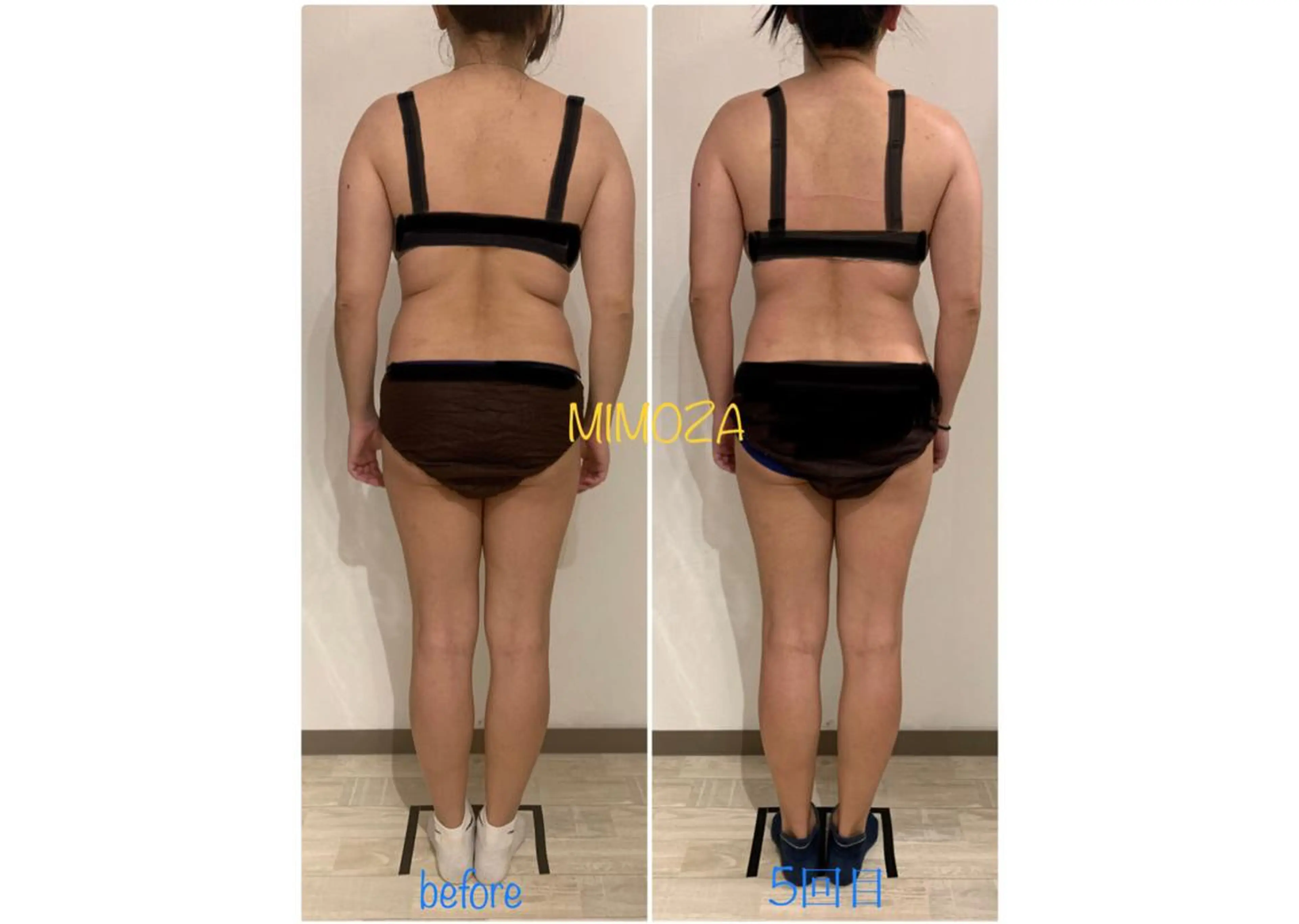 エステ リラク リンパマッサージ mimozaのエステ・リラクイメージ