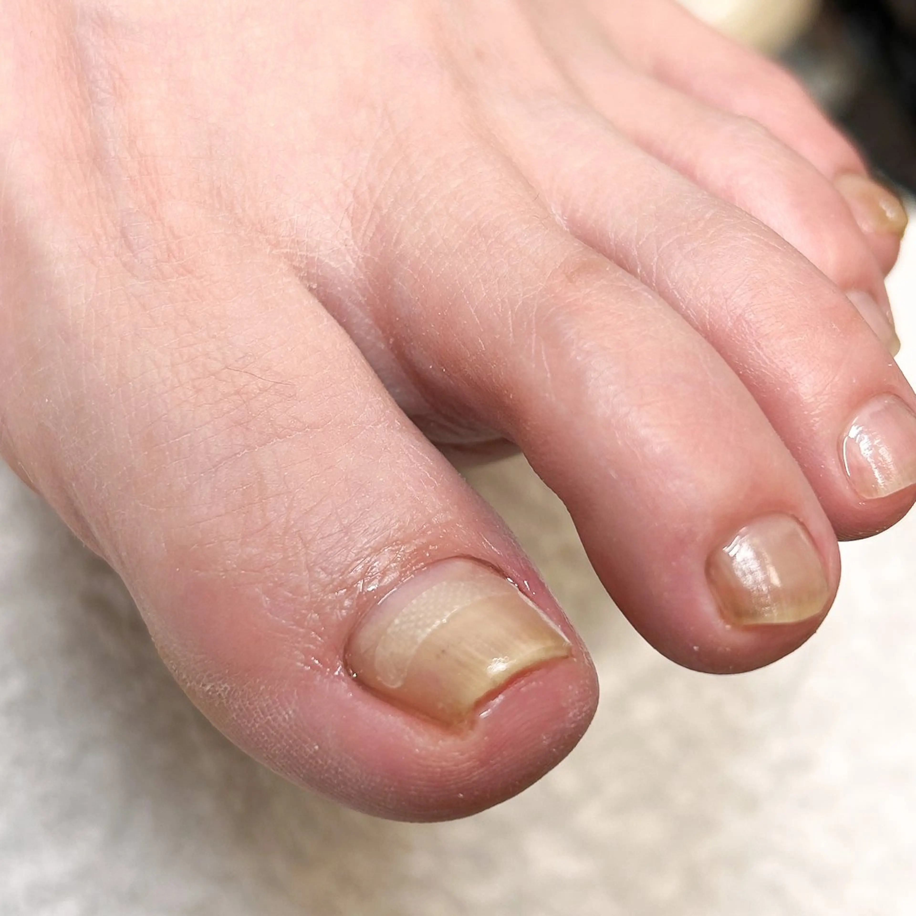 ネイル ケアが得意なサロン Happinailのエステ・リラクイメージ