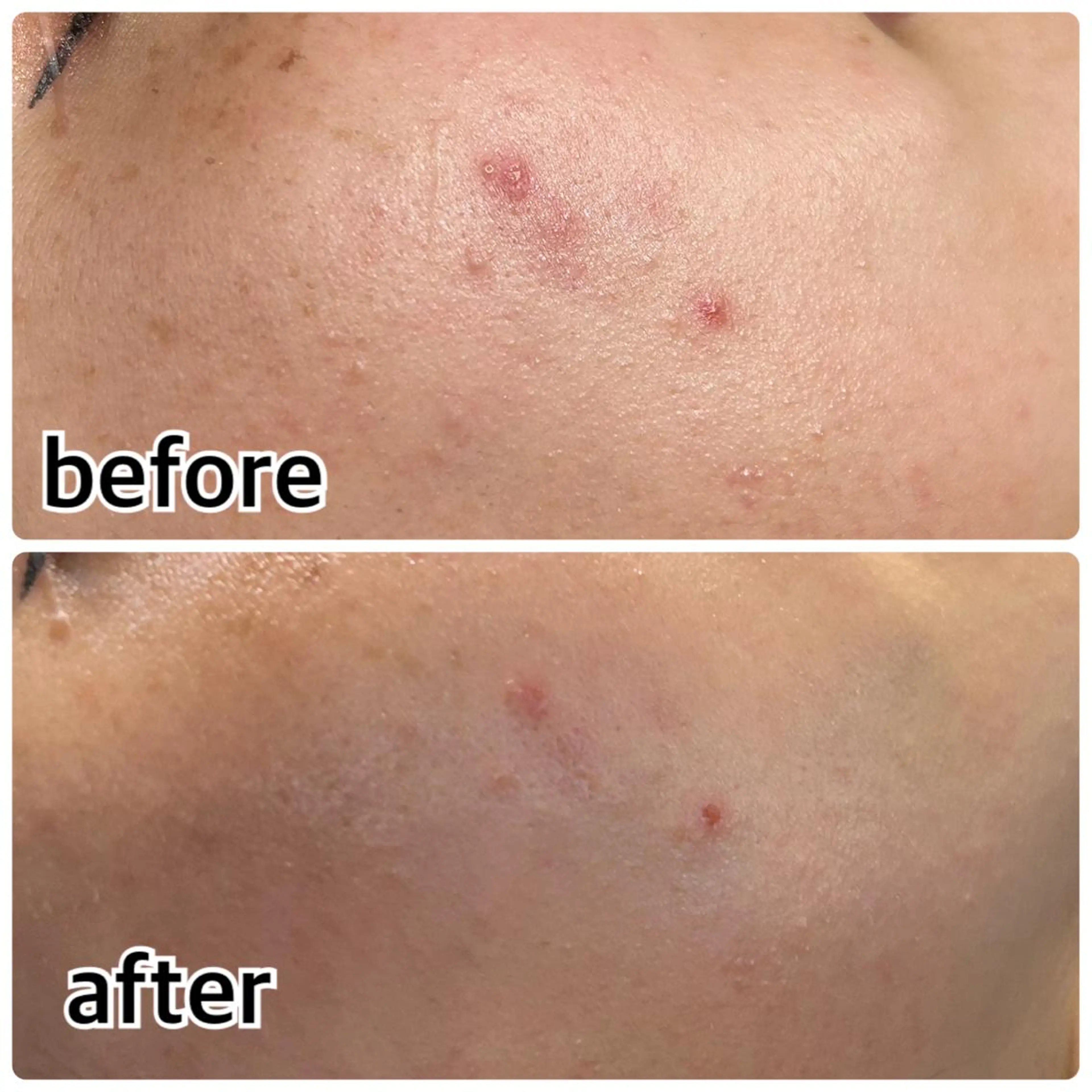 エステ Gemini 　MIKIのエステ・リラクイメージ