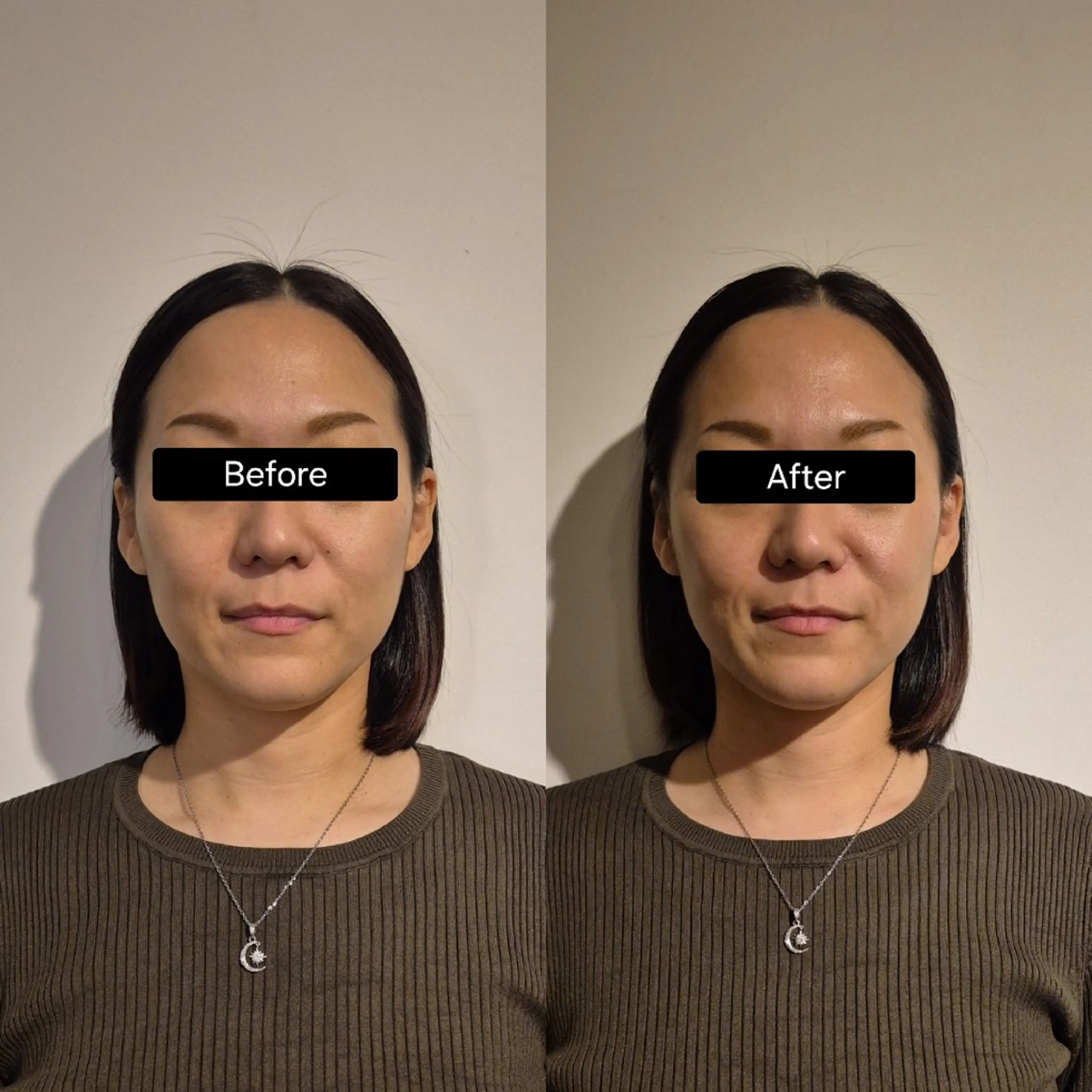 頭と顔の専門店LN│ ヘッドスパ×小顔矯正のエステ・リラクイメージ