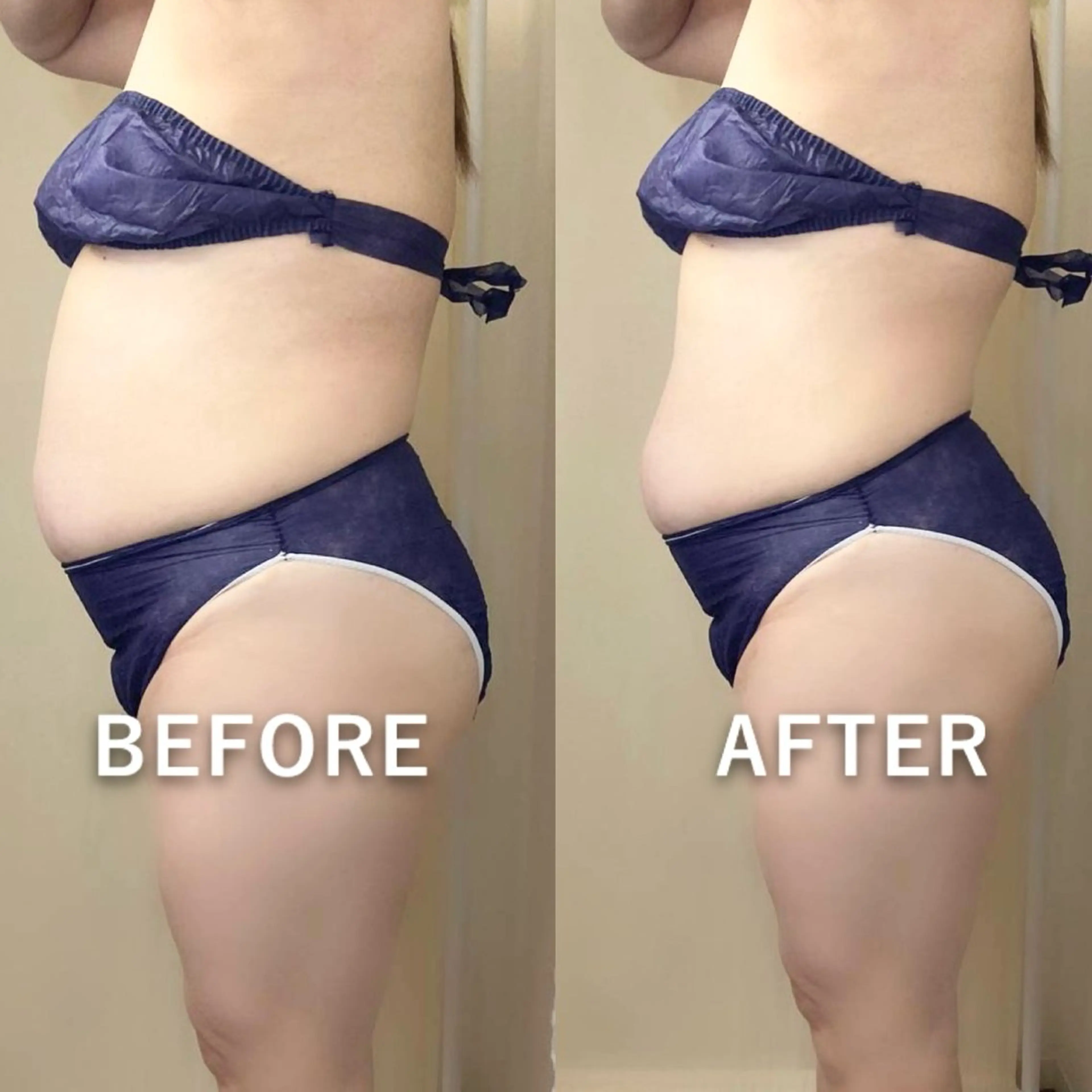 毛穴/いちご鼻/小顔 /hitohanaのエステ・リラクイメージ