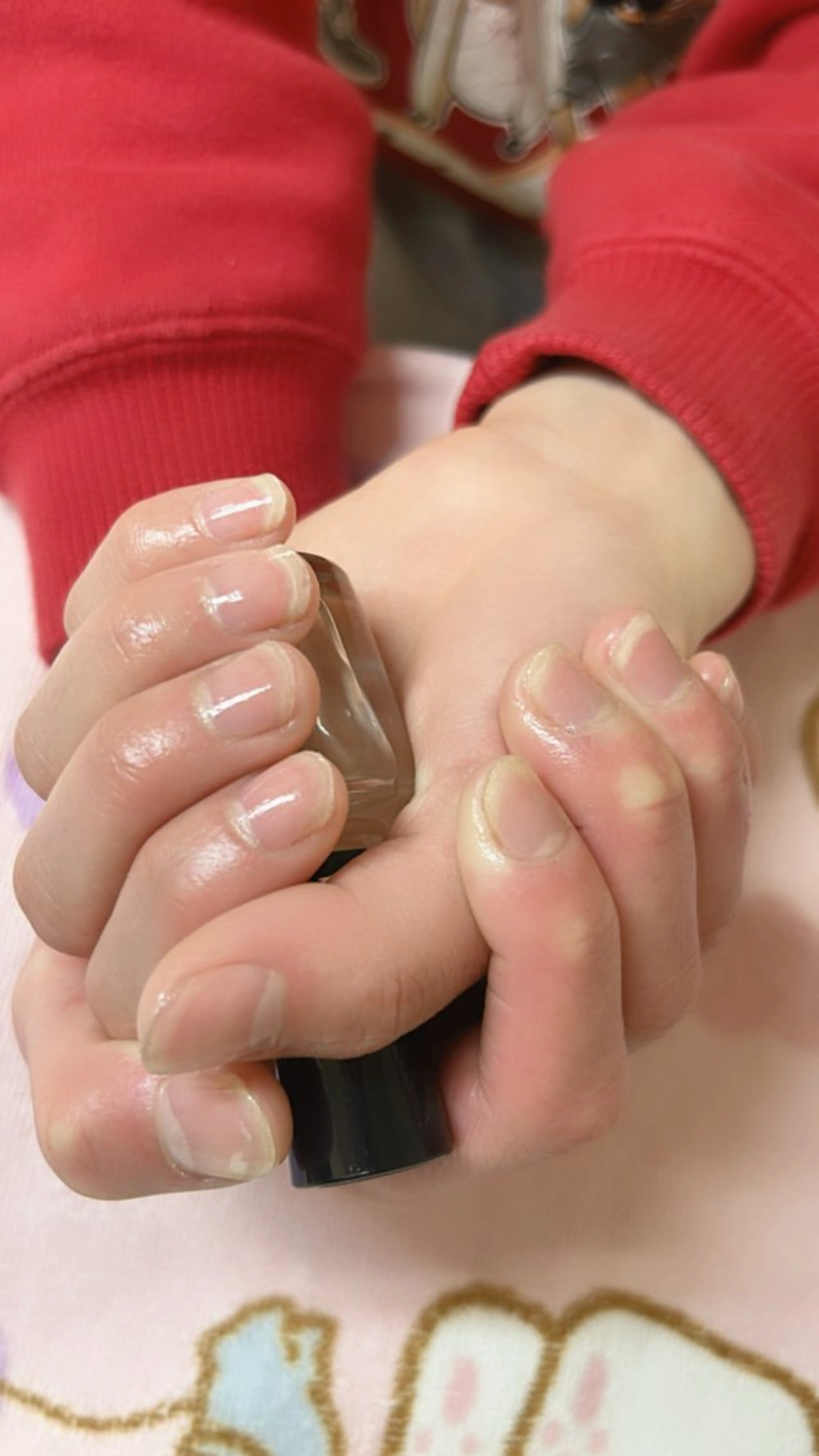 ネイル 肌質改善 ×ネイルサロンのネイルデザイン