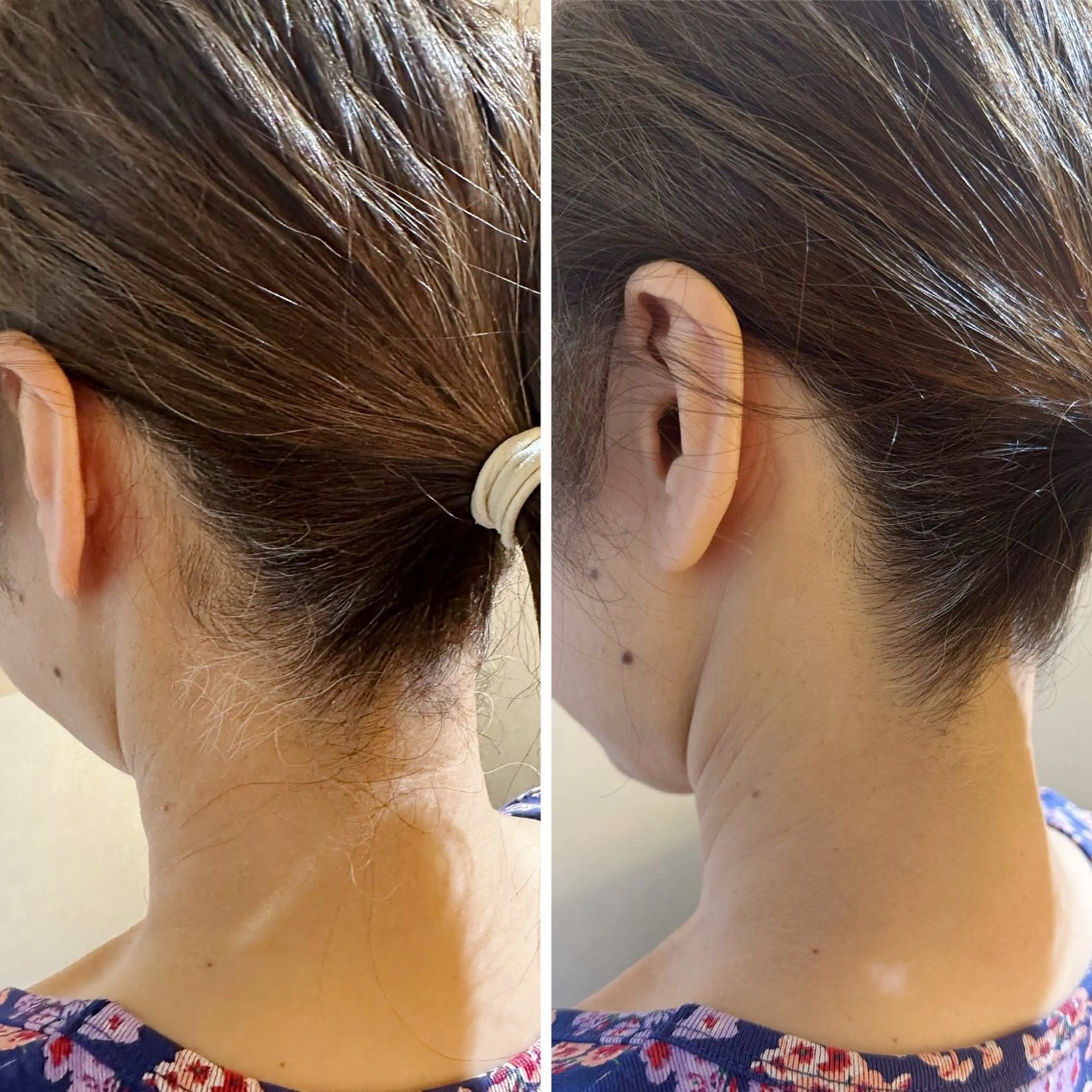 うなじ脱毛/美肌脱毛 LABELのエステ・リラクイメージ