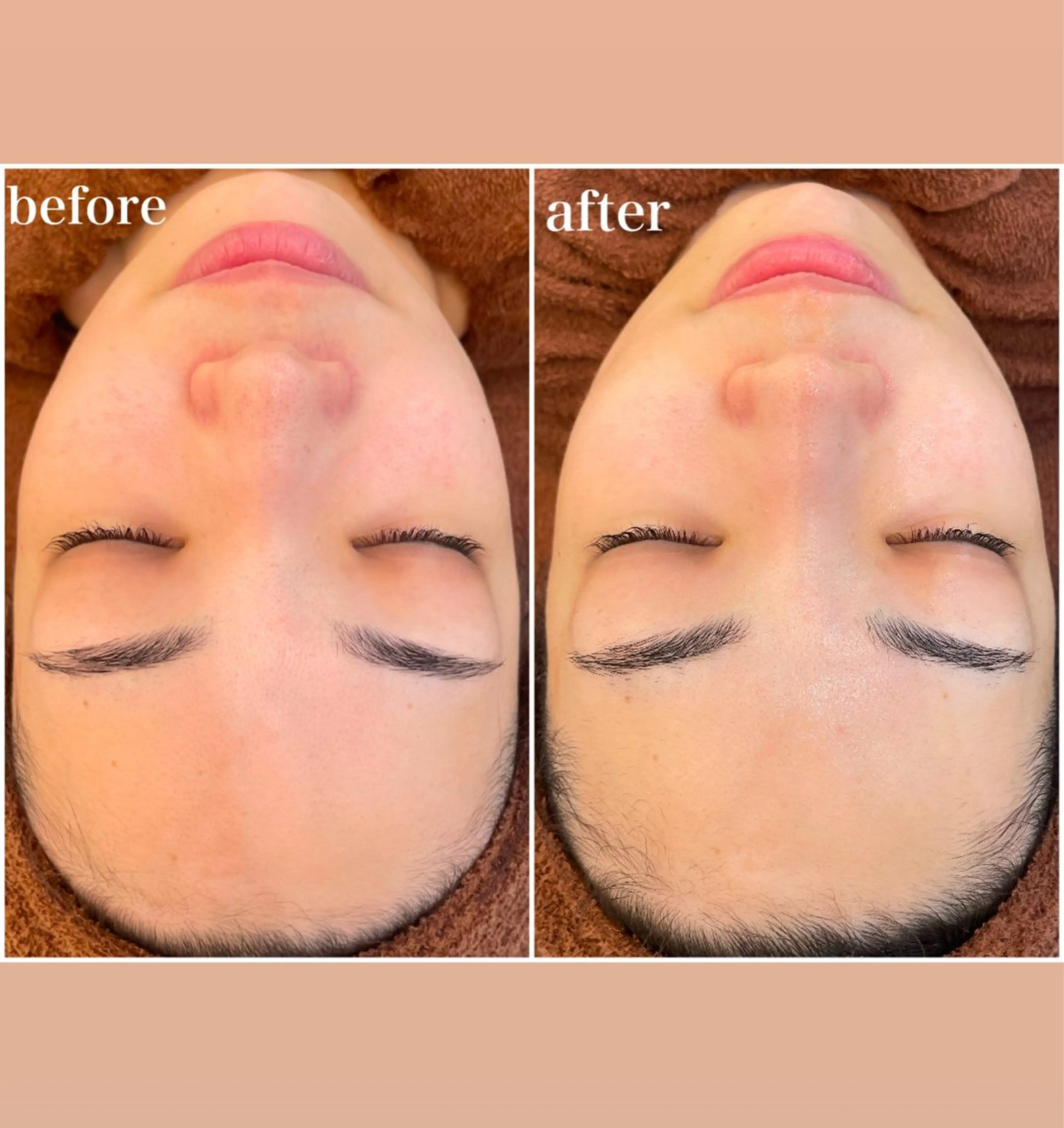 エステ リラク パーソナルスキンケア 🦋APRI🅿️有のエステ・リラクイメージ