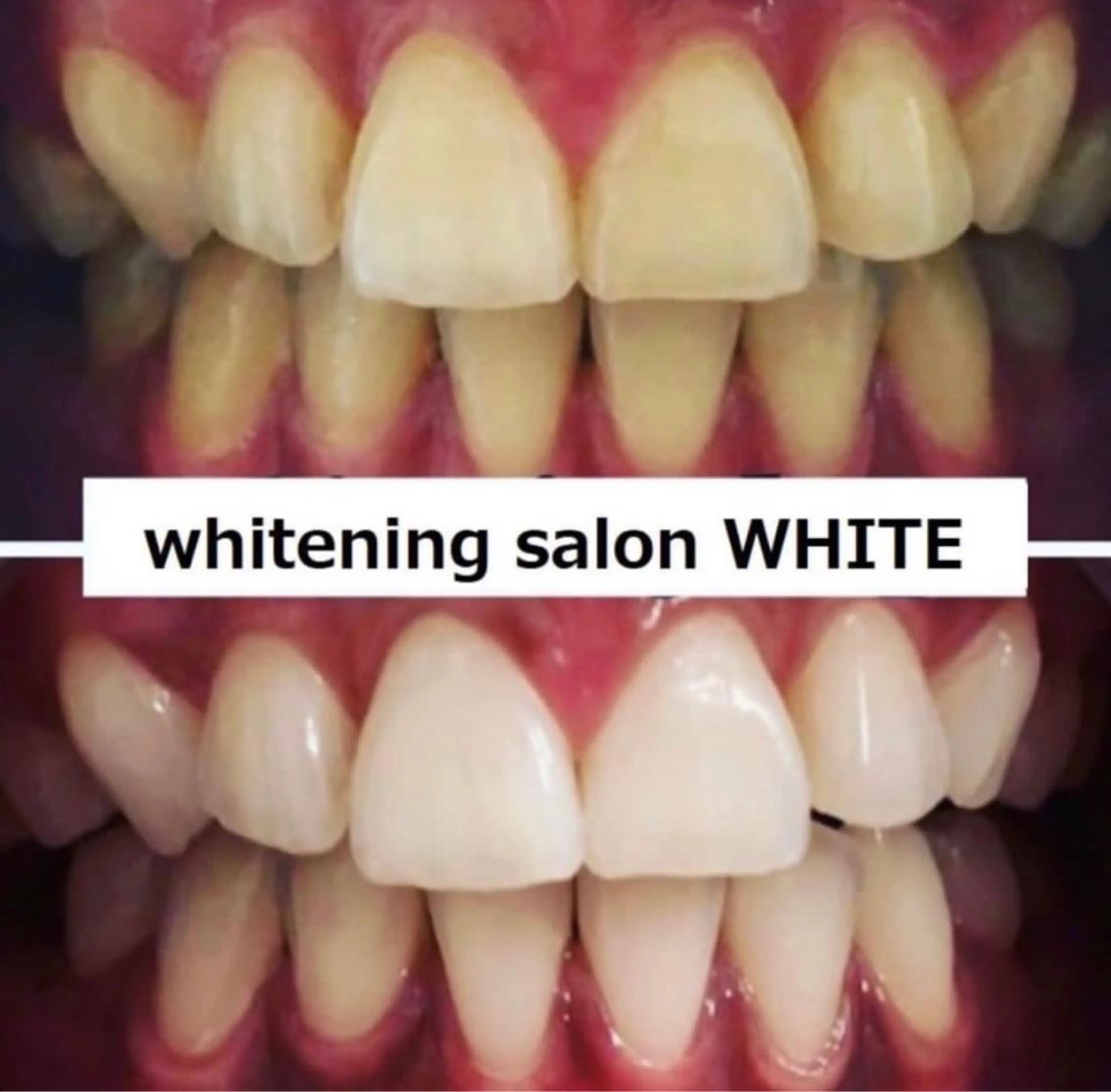 whitening salon WHITE 広島店所属・セルフホワイトニング 専門店WHITE広島のその他イメージ