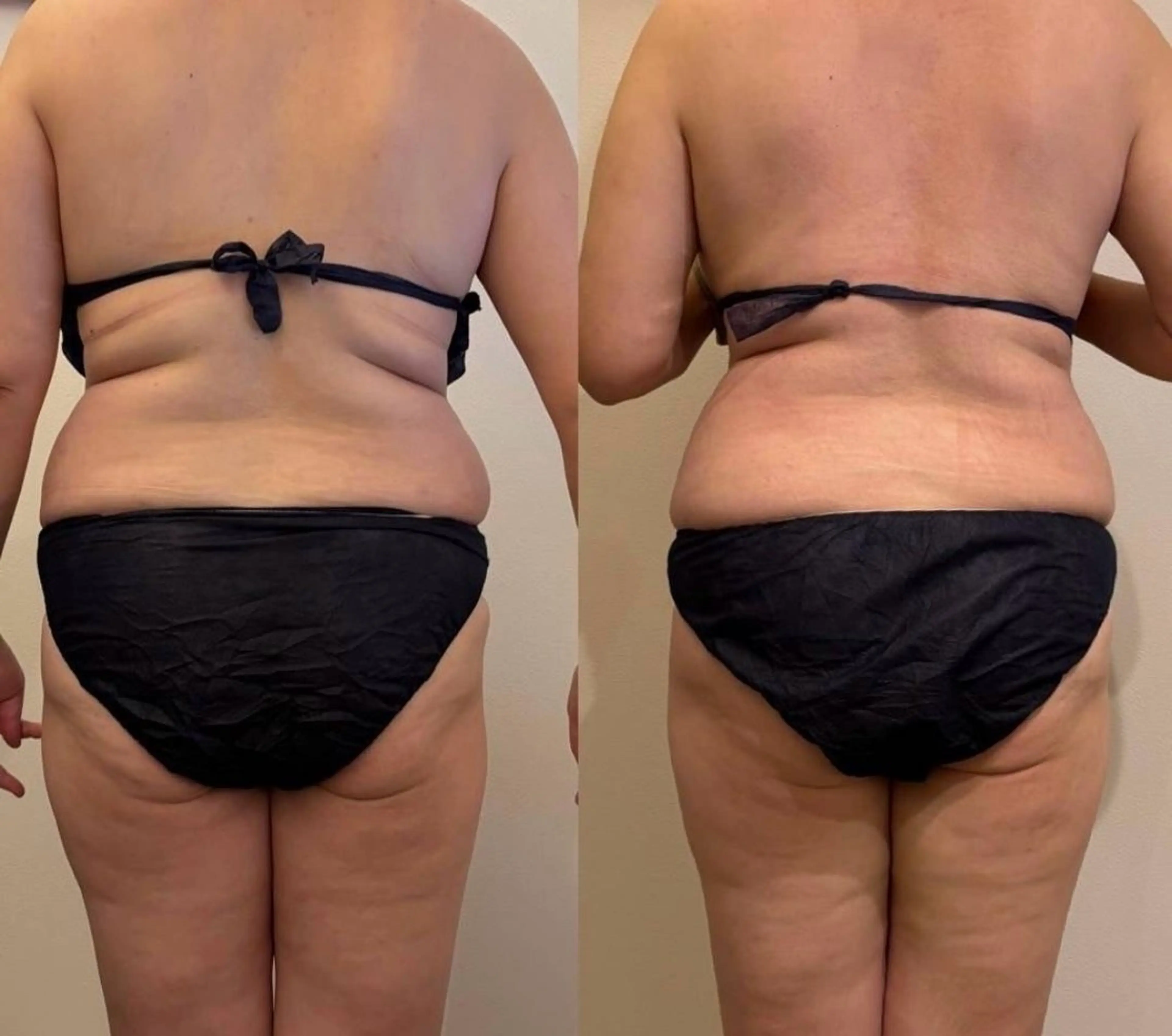 リラク Ellebeauty relaxationのエステ・リラクイメージ