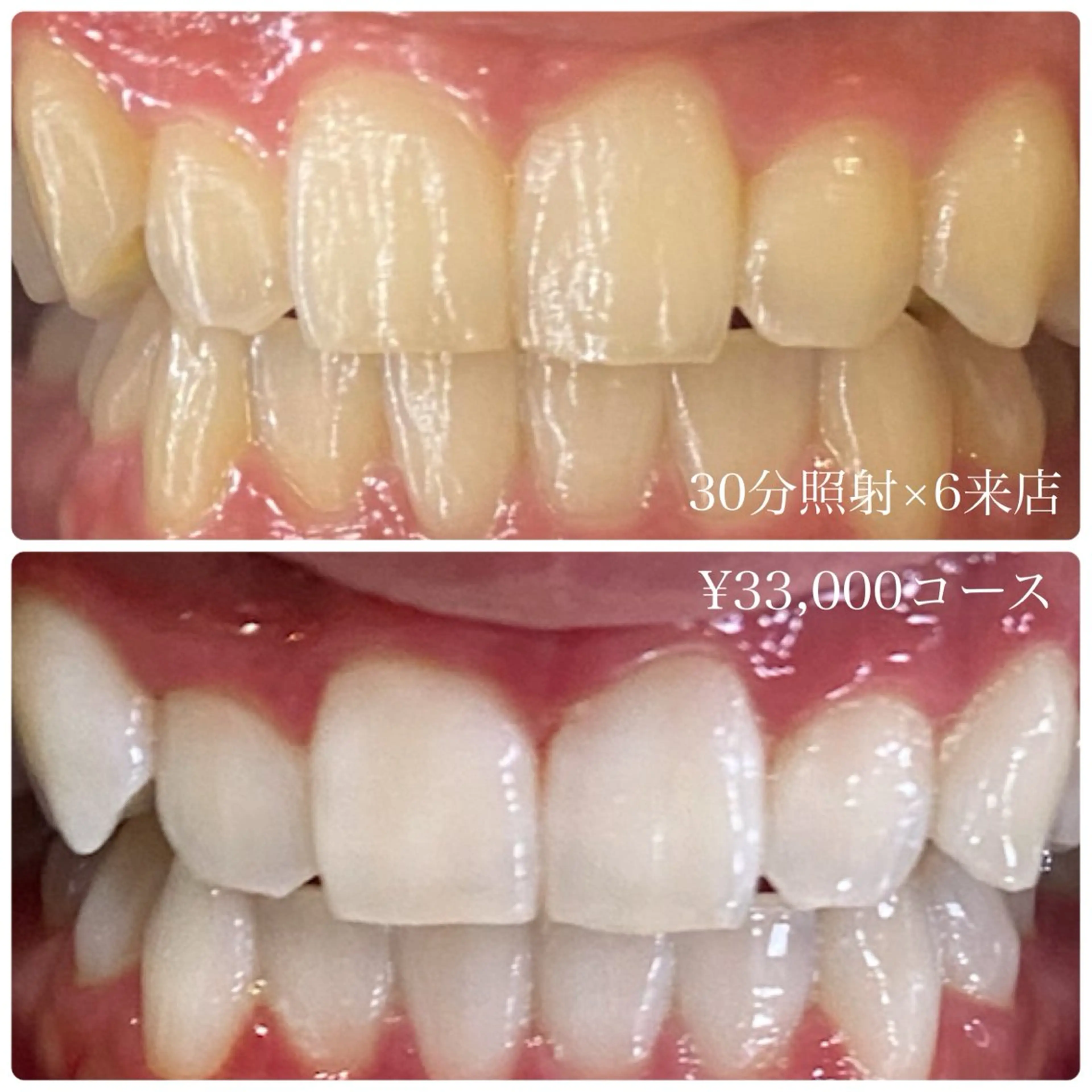 メンズ その他 ホワイトニングルーム　川崎店所属・ホワイトニング ルーム　川崎店のその他イメージ