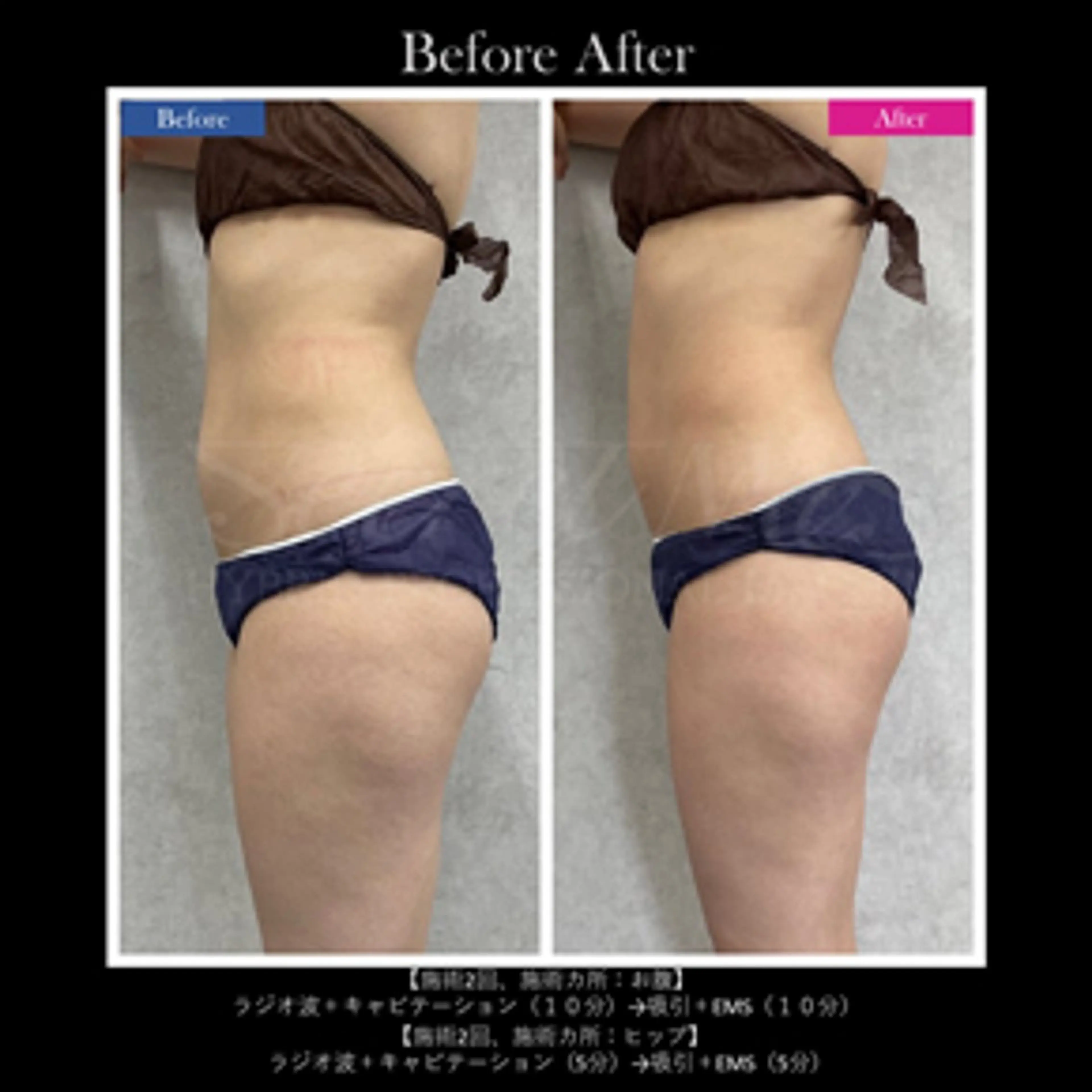 伊藤 正美のマツエク・マツパデザイン