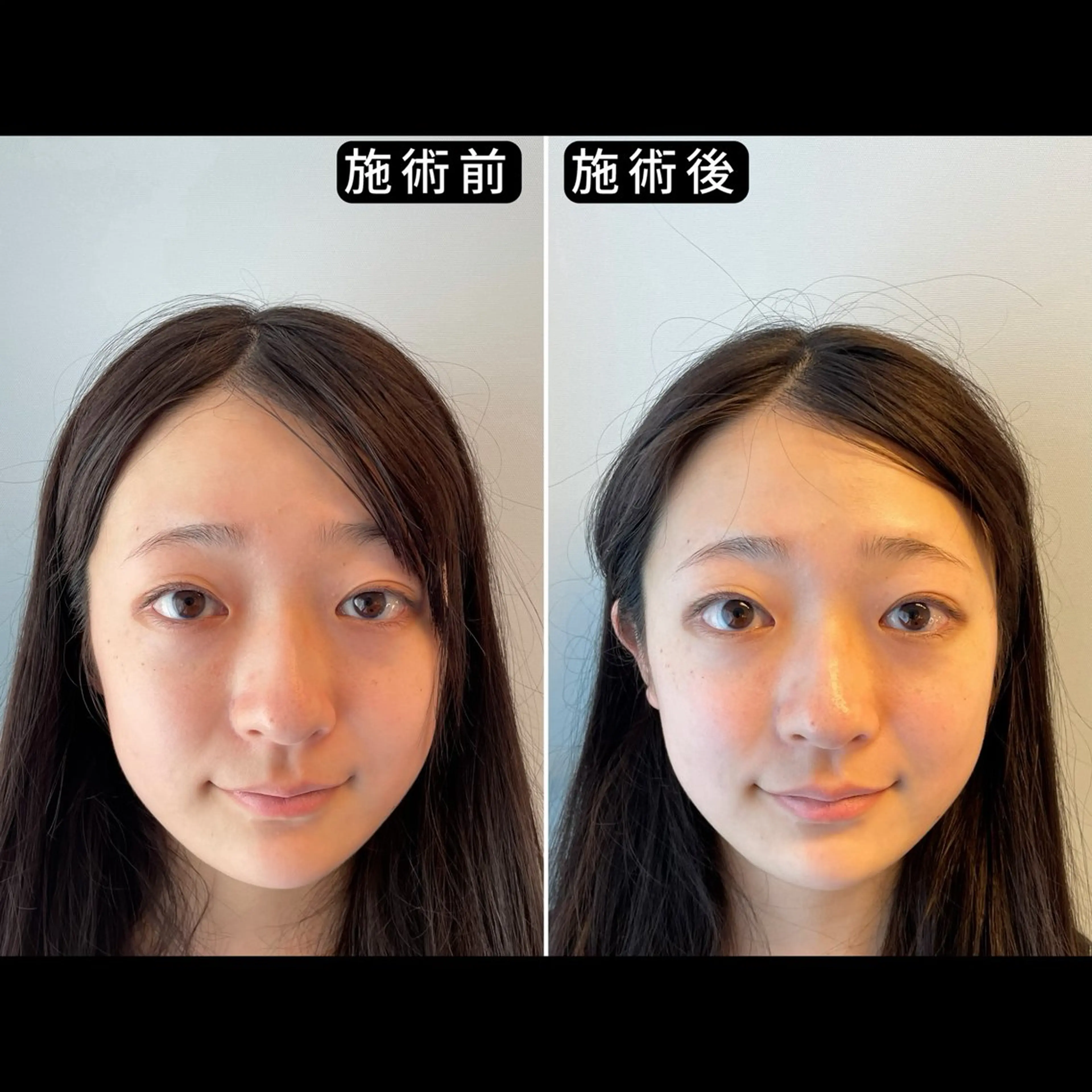 リラク 渋谷 小顔美容鍼 専門サロン YZのエステ・リラクイメージ