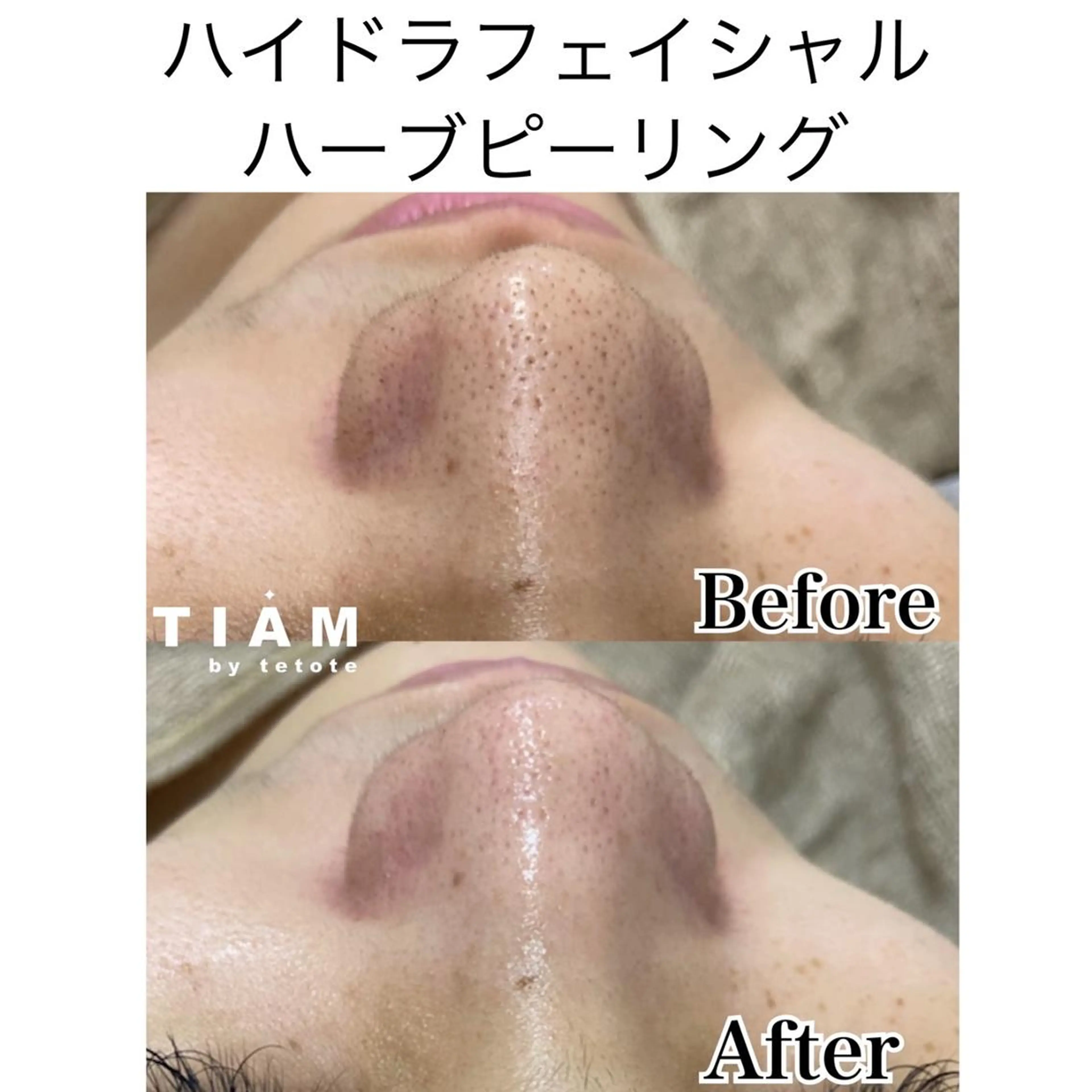 美肌サロンTIAM by tetoteのエステ・リラクイメージ