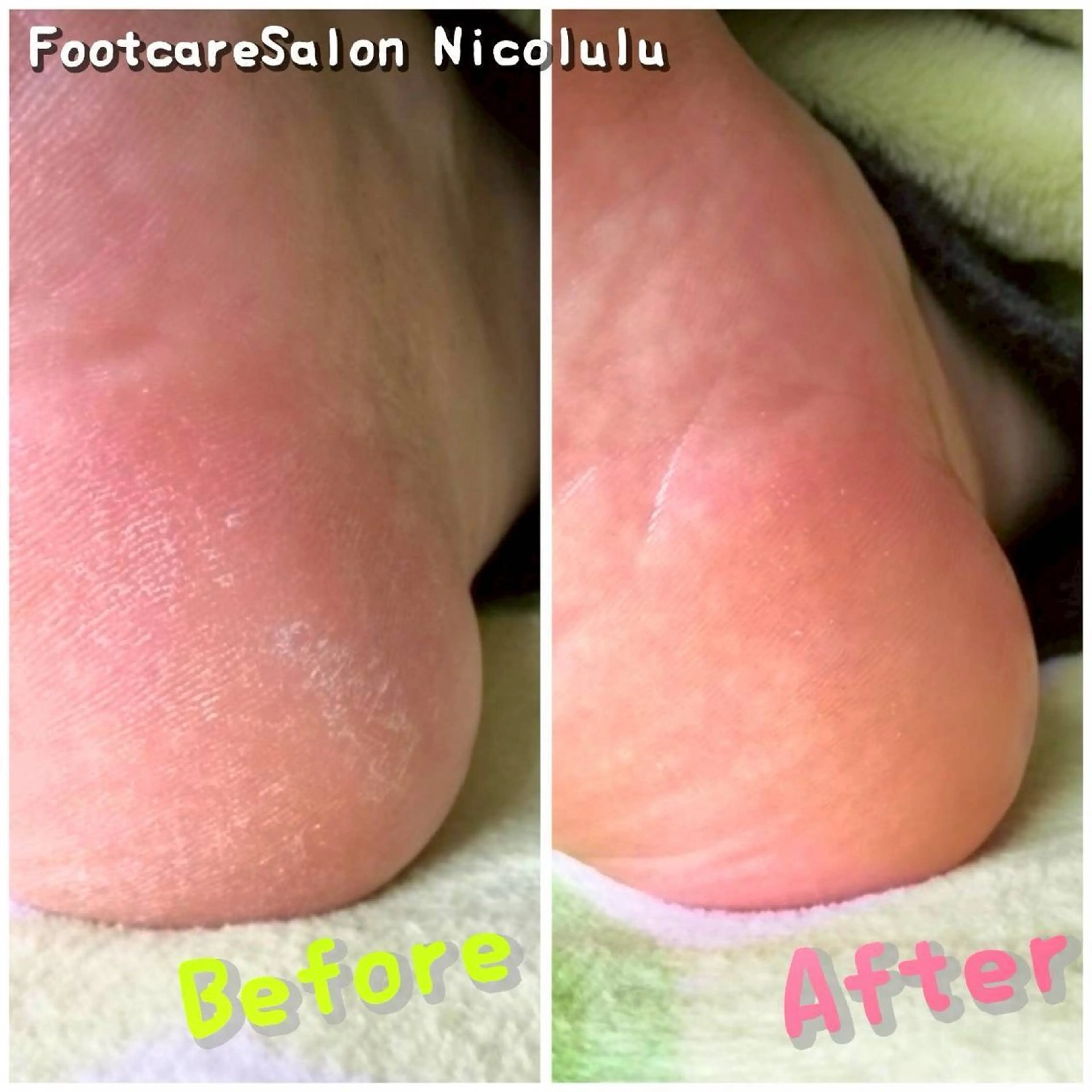 リラク 足トラブル専門 ニコルル金沢のエステ・リラクイメージ