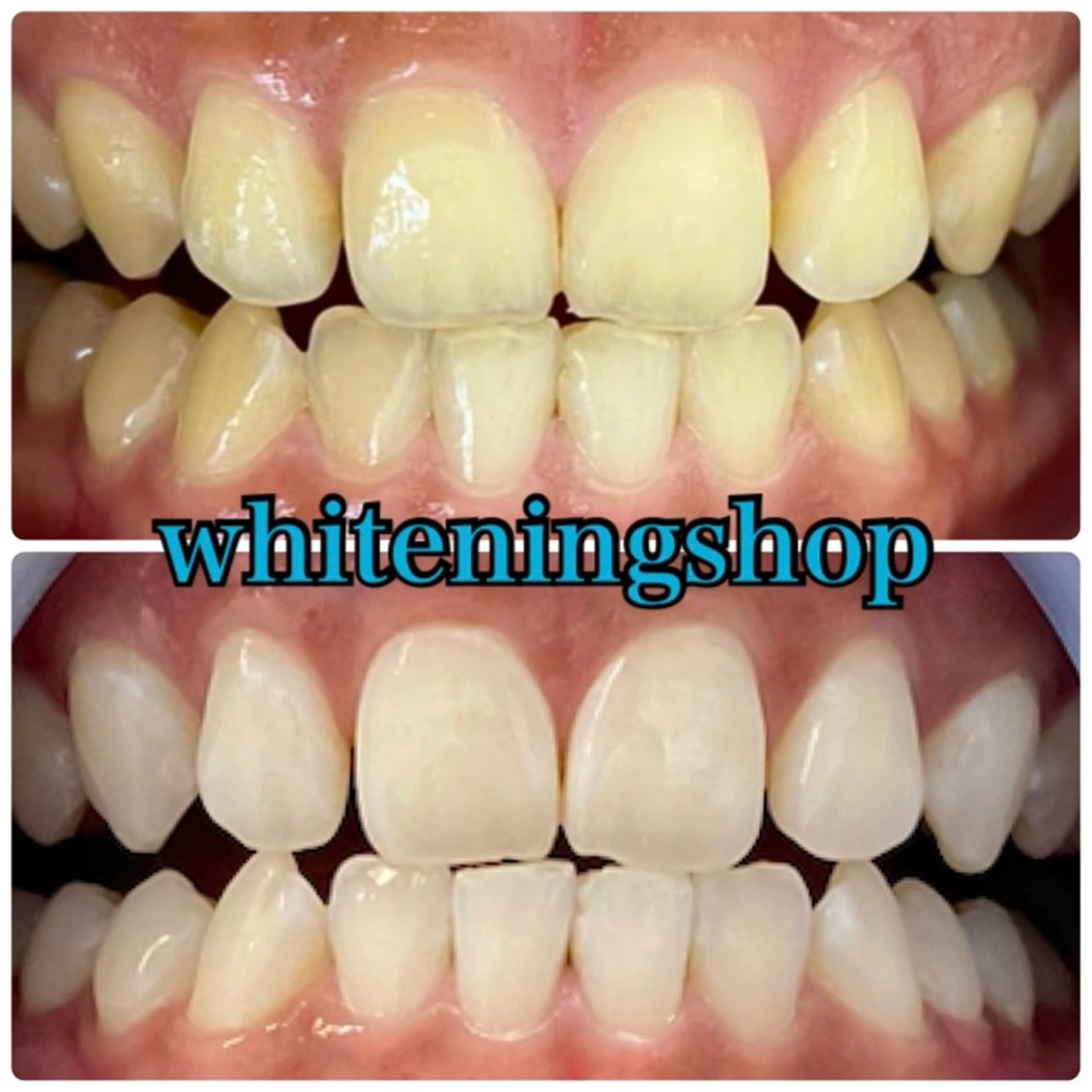 エステ リラク ホワイトニング ショップ吉祥寺店のエステ・リラクイメージ