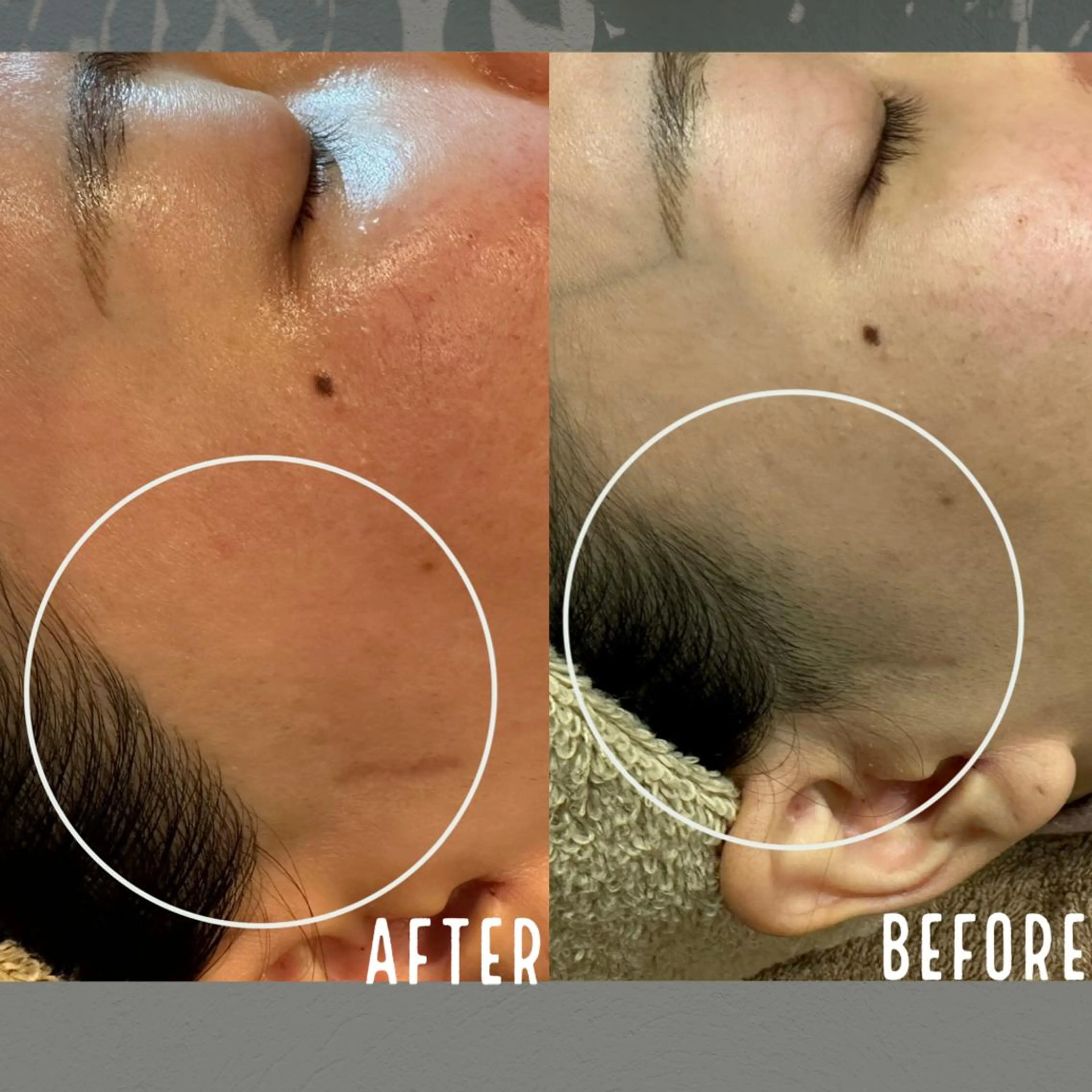 脱毛 KOHOLA -ワックス脱毛専門-のエステ・リラクイメージ