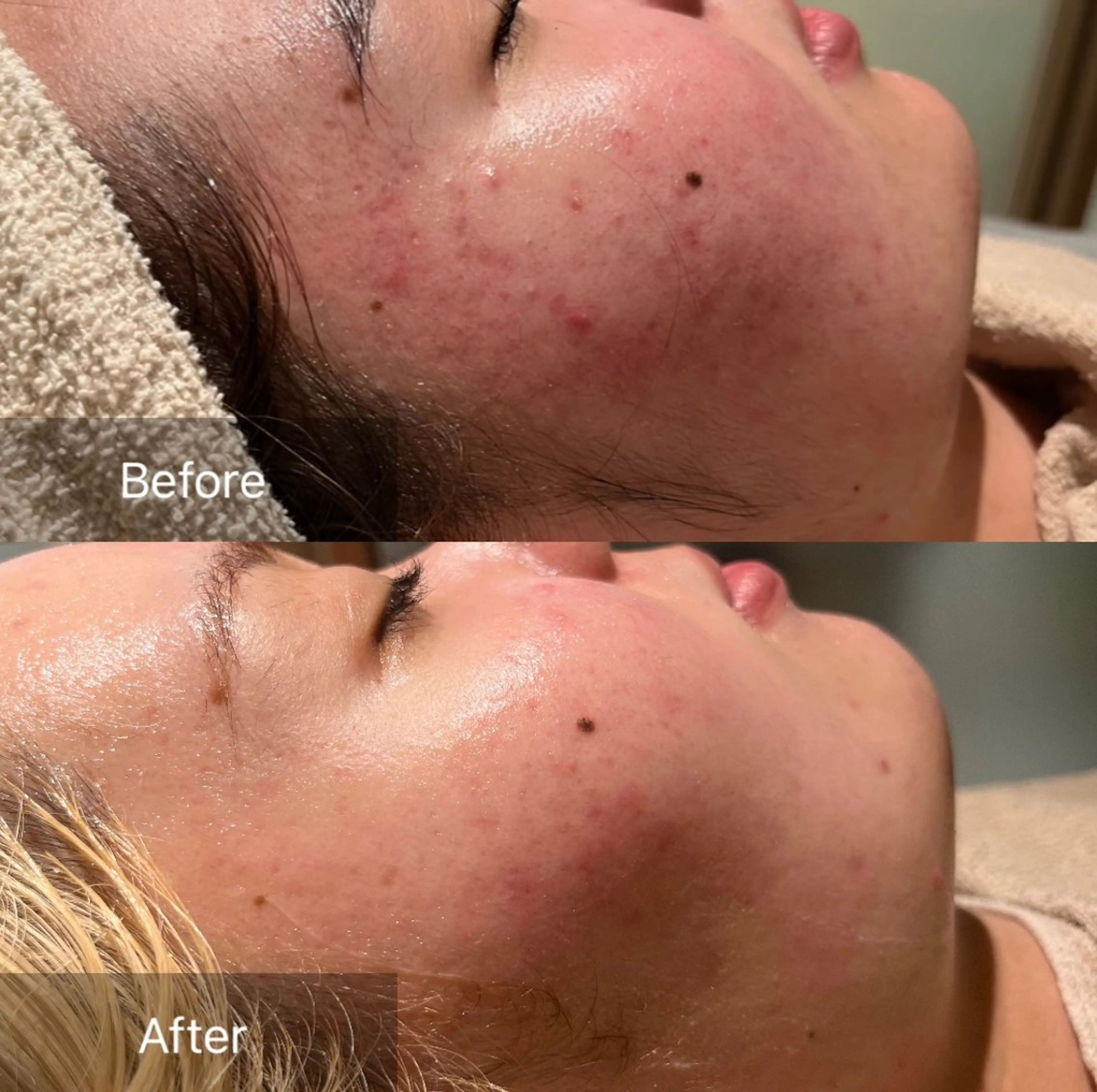 その他 森 美優のエステ・リラクイメージ