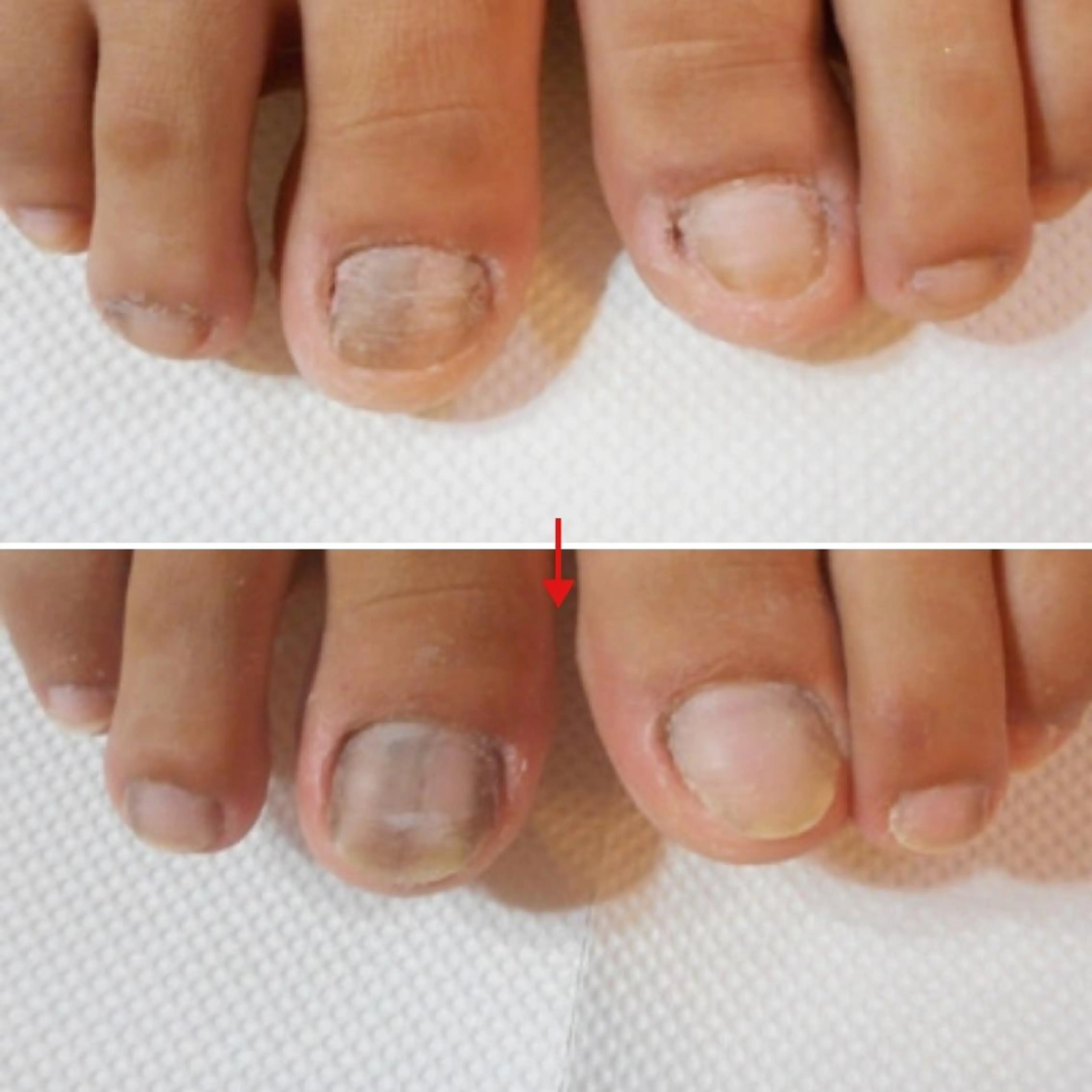 ネイル ネイルサロン アリュームのネイルデザイン