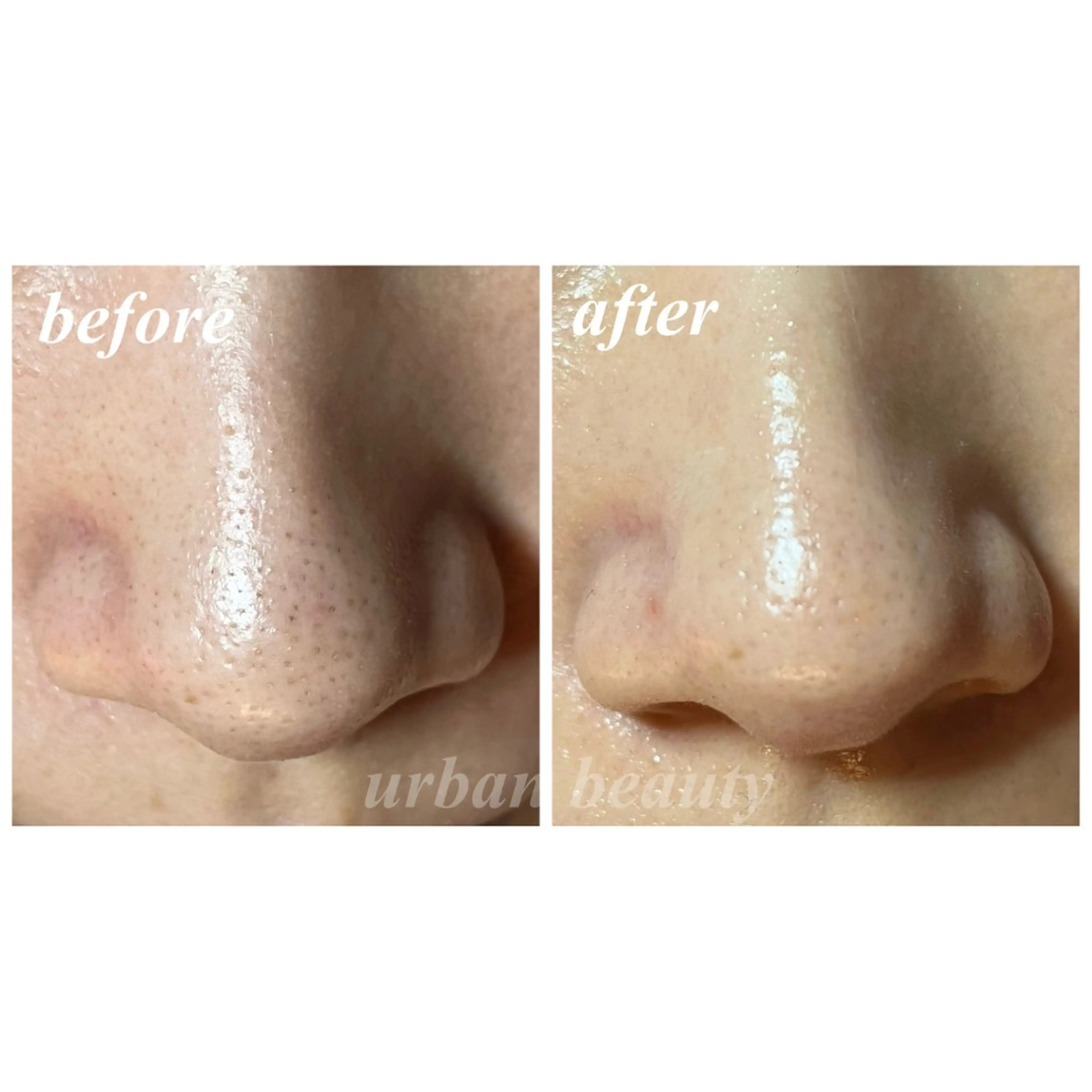 結果重視｜毛穴エステ ｜友綱理恵のエステ・リラクイメージ