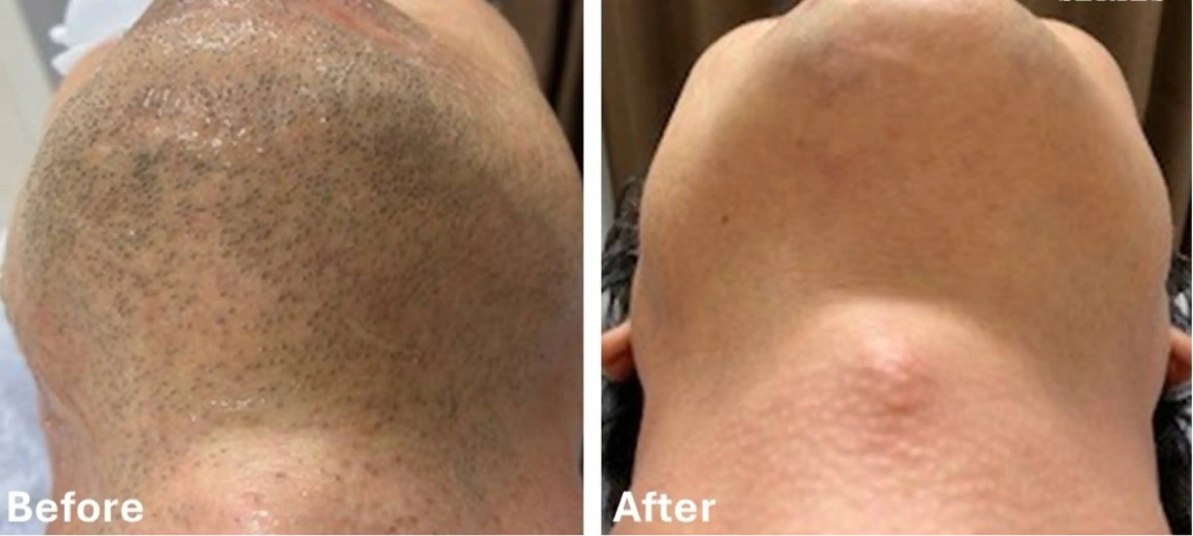 VANILLA SKYのエステ・リラクイメージ