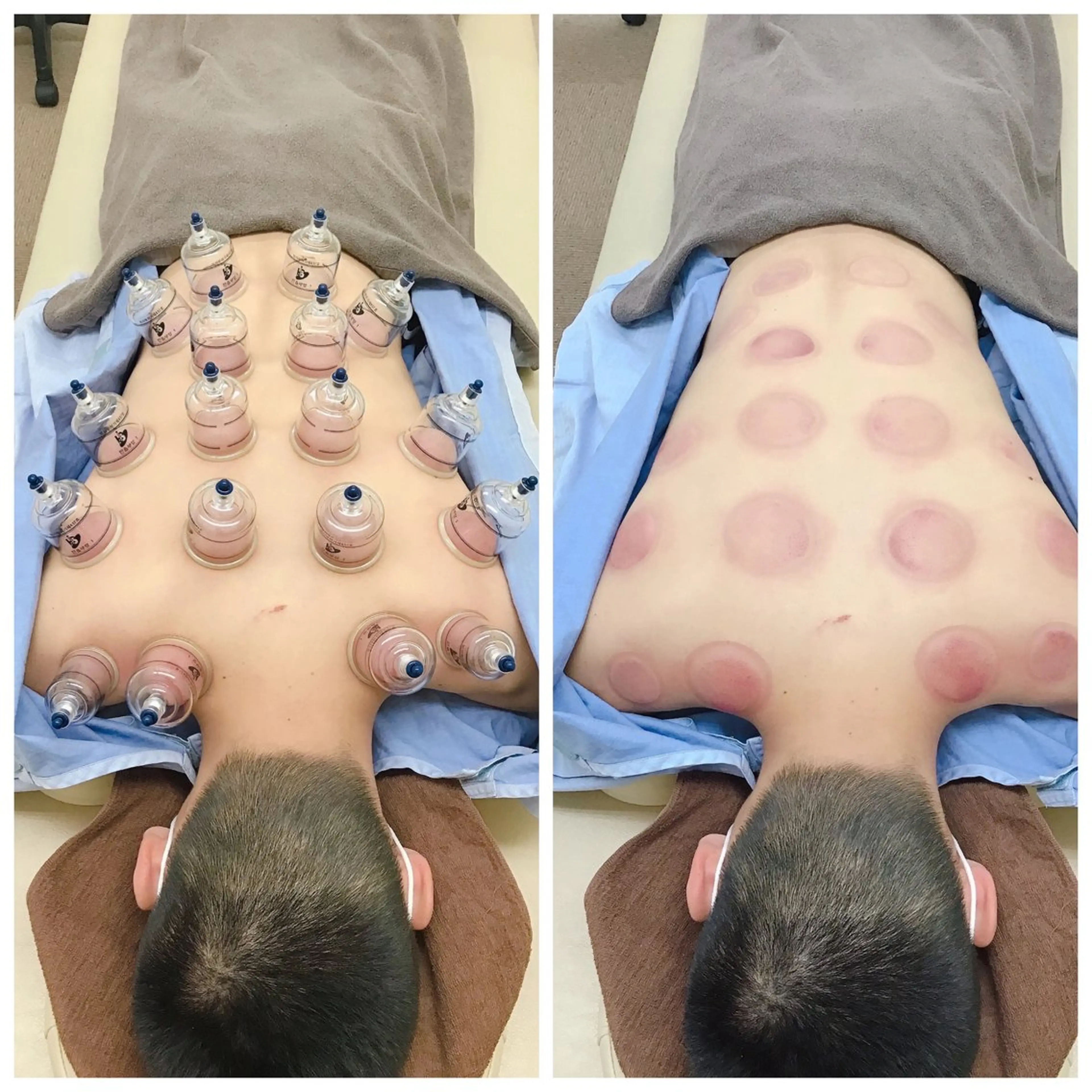 まごころ鍼灸整骨院 京王堀之内院のエステ・リラクイメージ