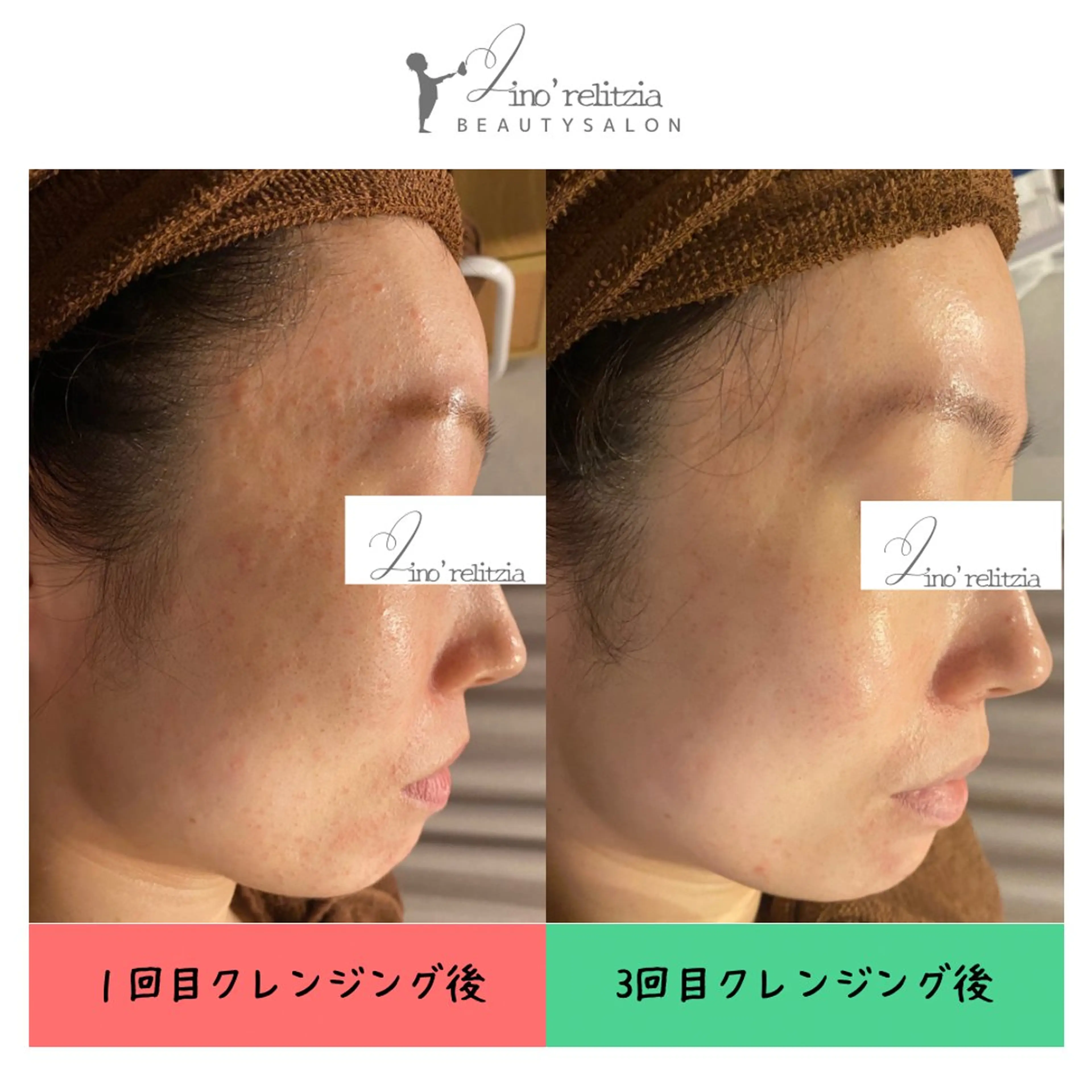 リノレリチア 心斎橋・新町店のエステ・リラクイメージ