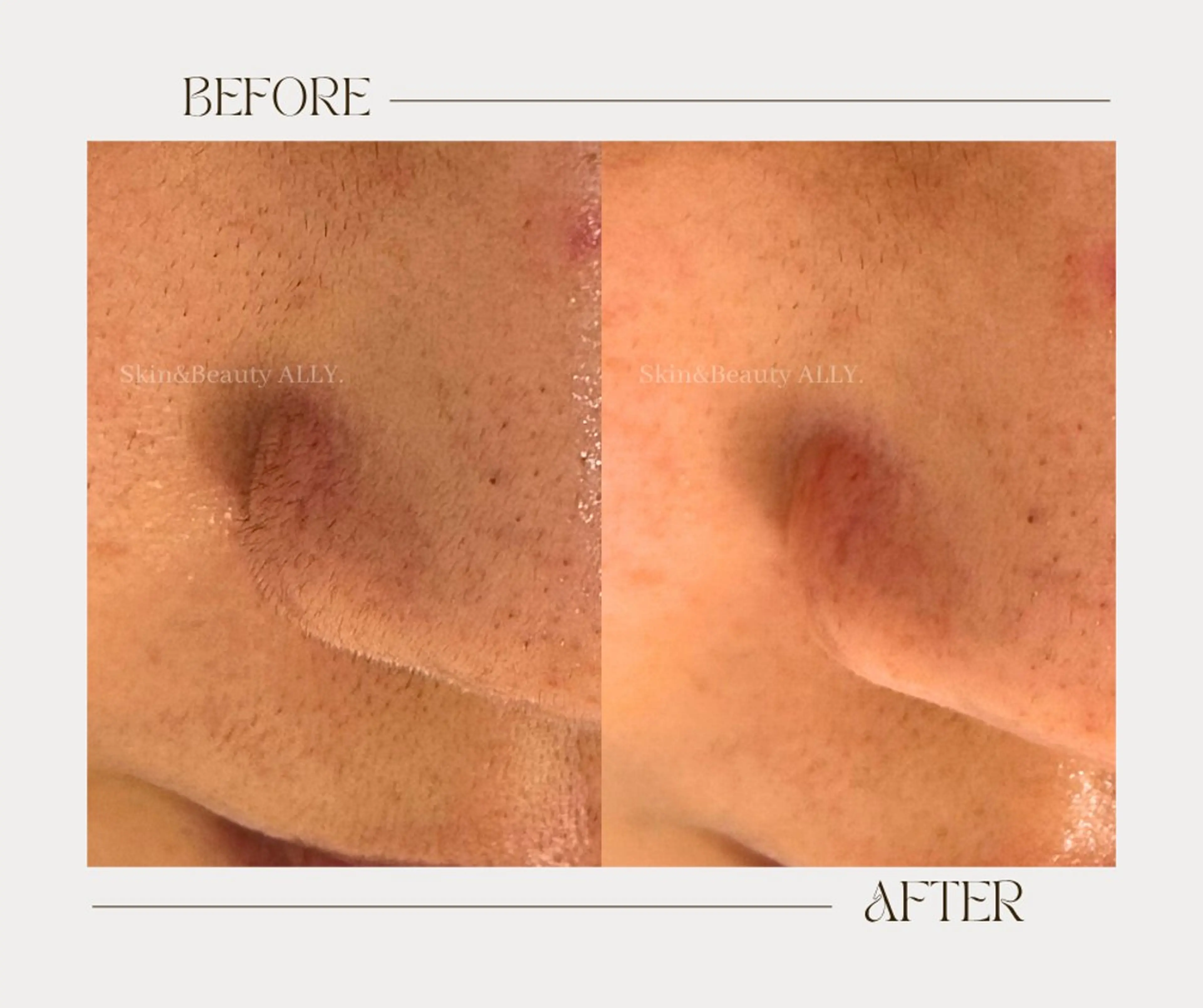 その他 艶肌ワックス ALLY.のエステ・リラクイメージ