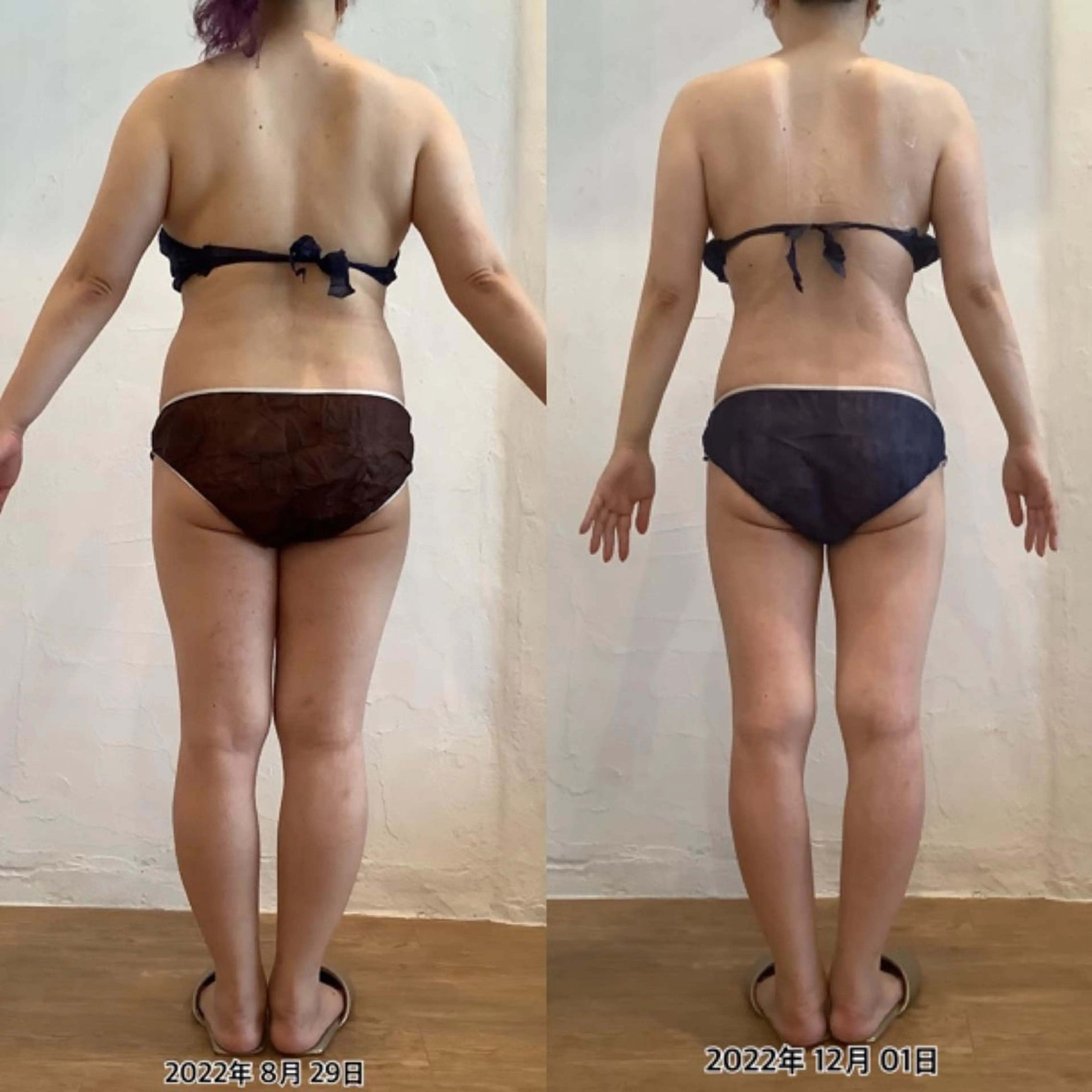 エステ リラク むくみ専門痩身 マクイエステティックのエステ・リラクイメージ