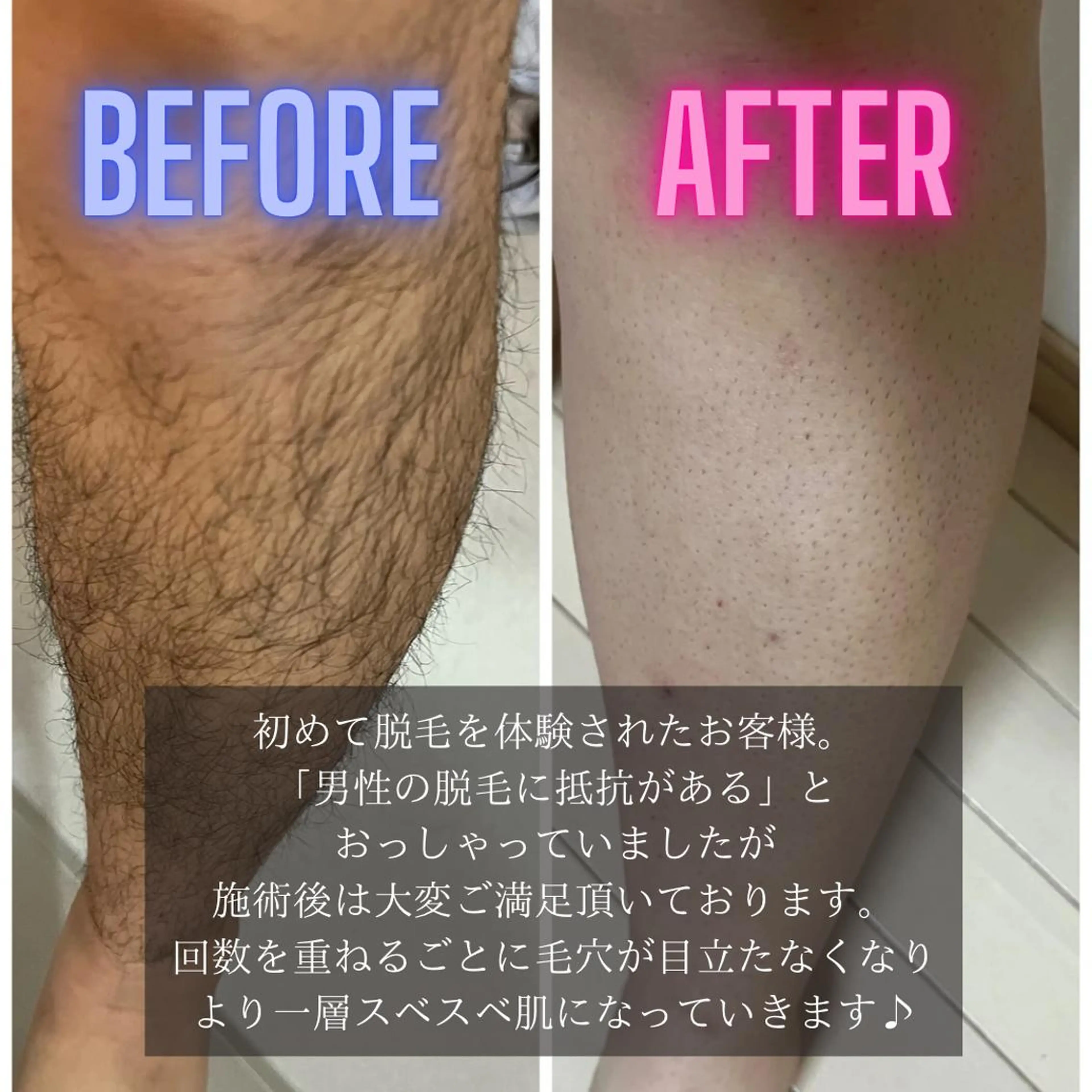 メンズ 脱毛 FOX 心斎橋店のエステ・リラクイメージ