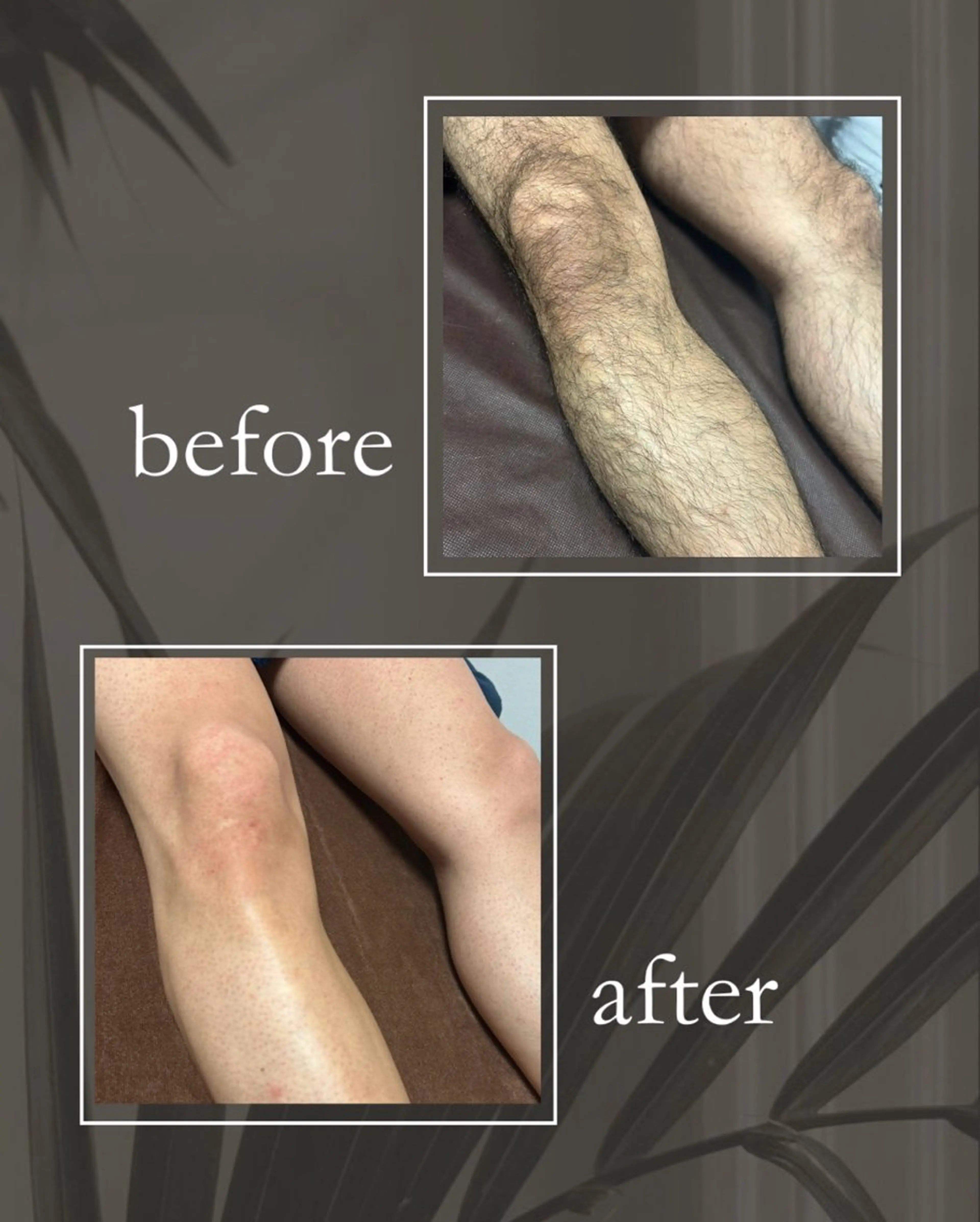 メンズ 脱毛 砂原 慧子のエステ・リラクイメージ