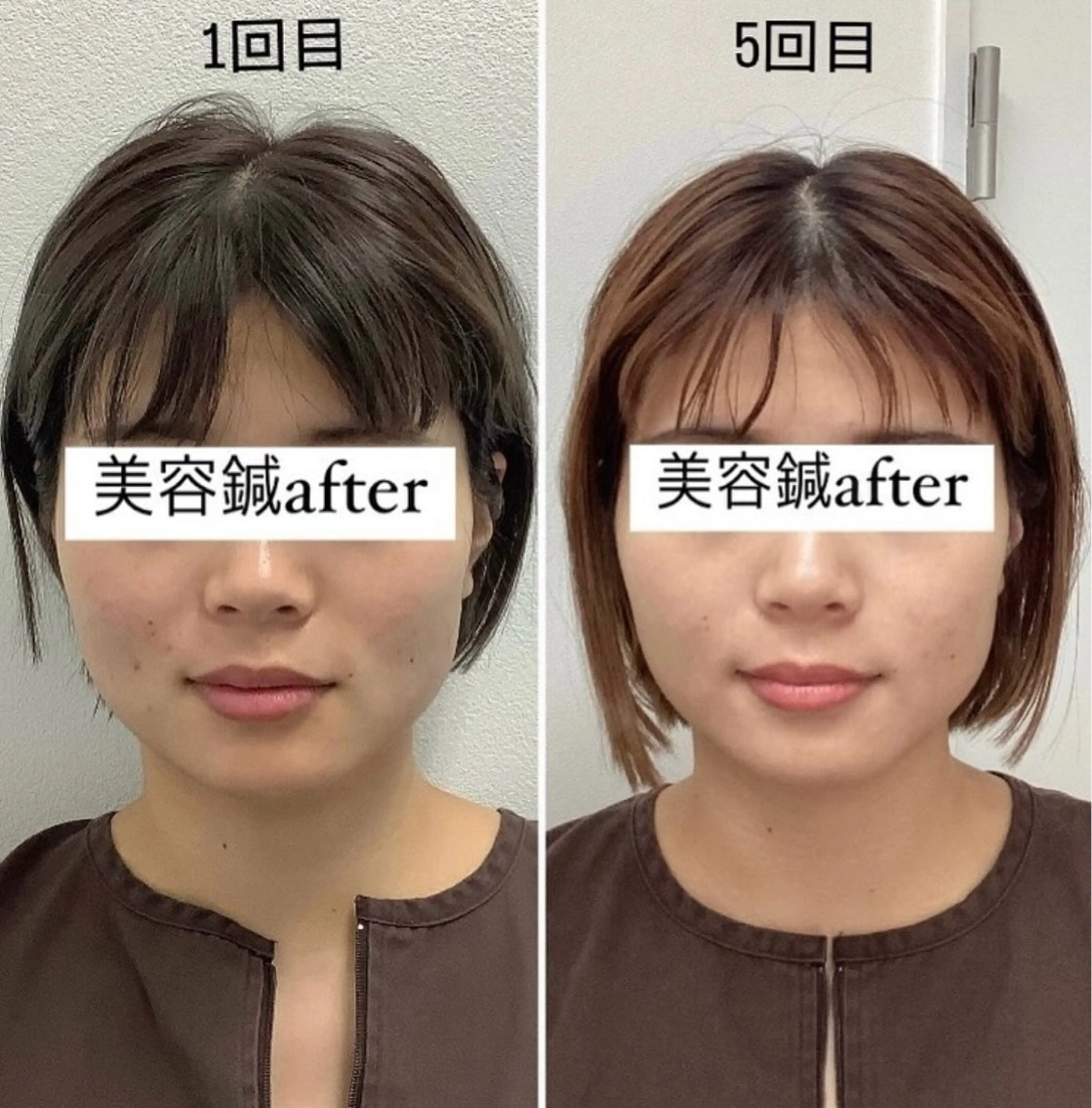エステ リラク 美容鍼灸×小顔整体♡ ハリサロンドオフ堺東のその他イメージ