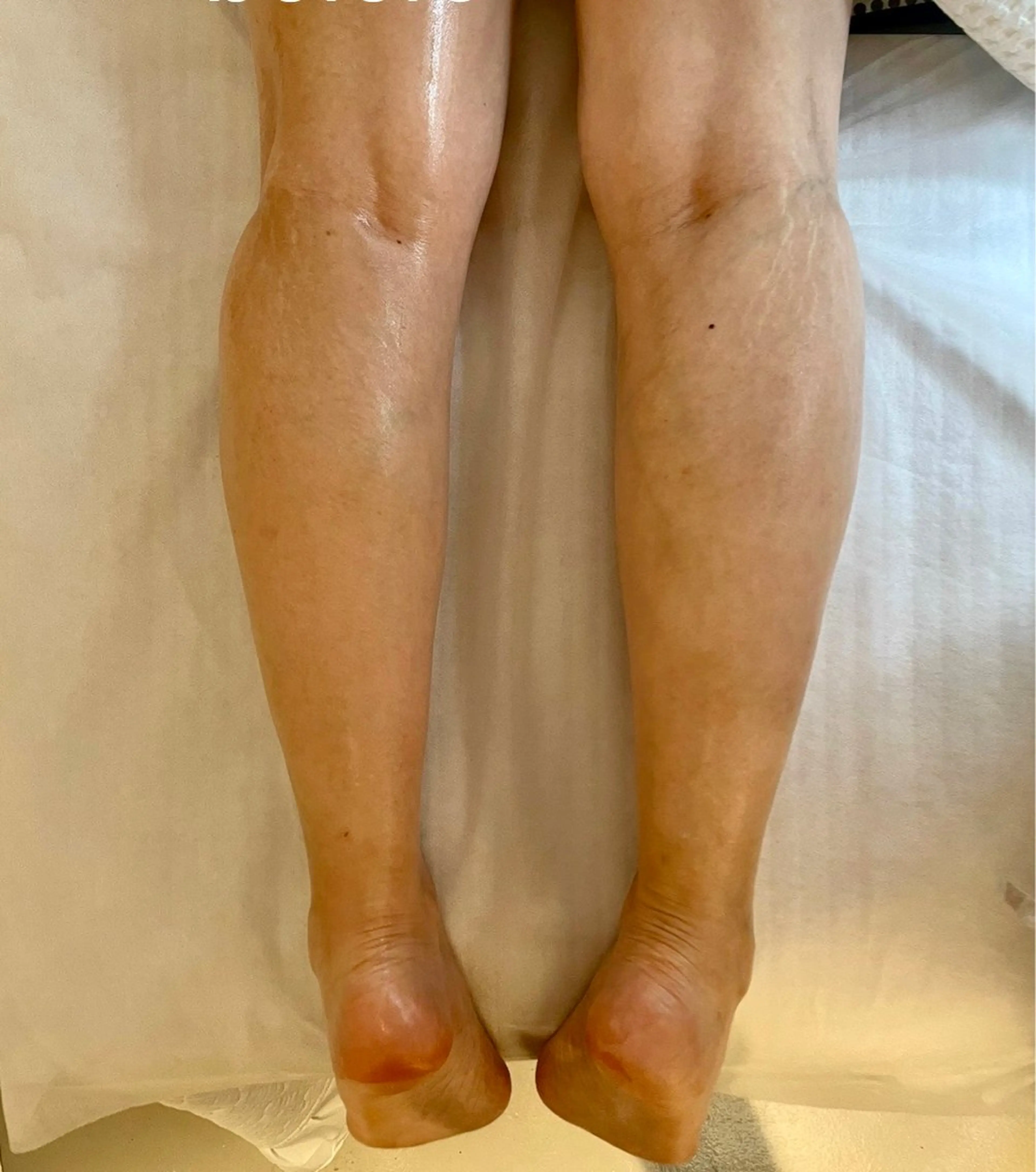 UNWIND アンワインドのエステ・リラクイメージ