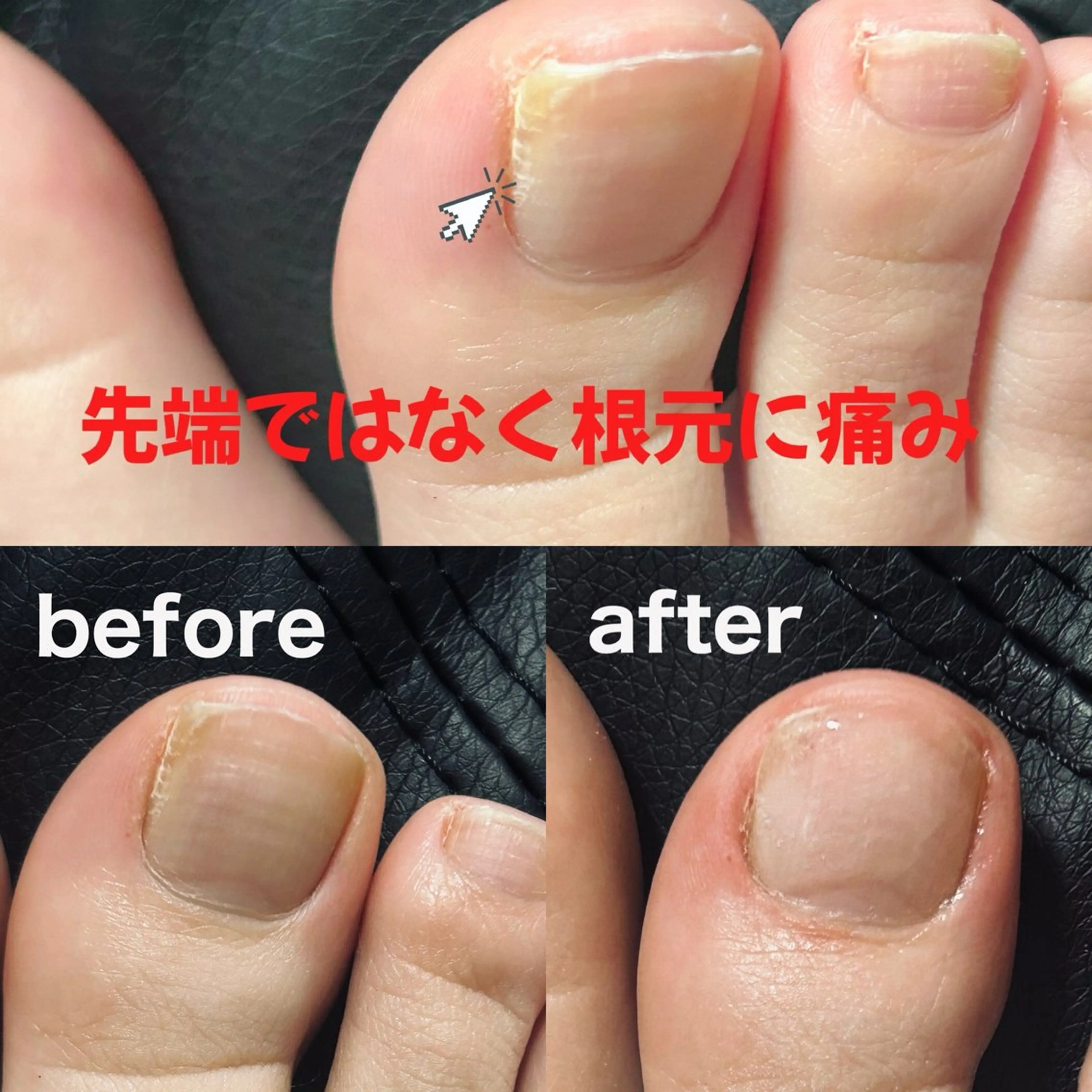 巻き爪フットケアサロンKotori所属・フットケアサロン Kotoriのその他イメージ