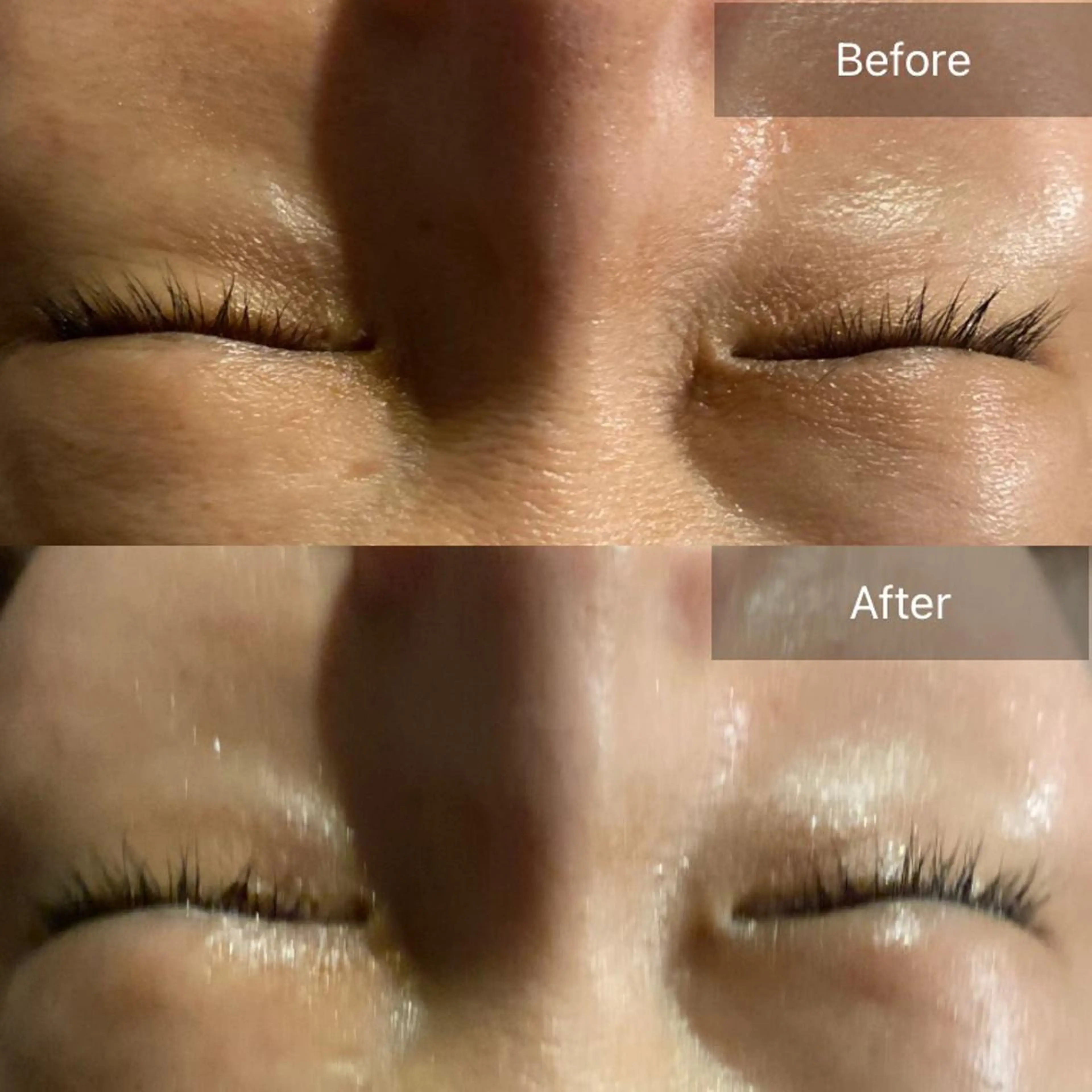 毛穴から始める肌メン テマンダリンオレンジのエステ・リラクイメージ