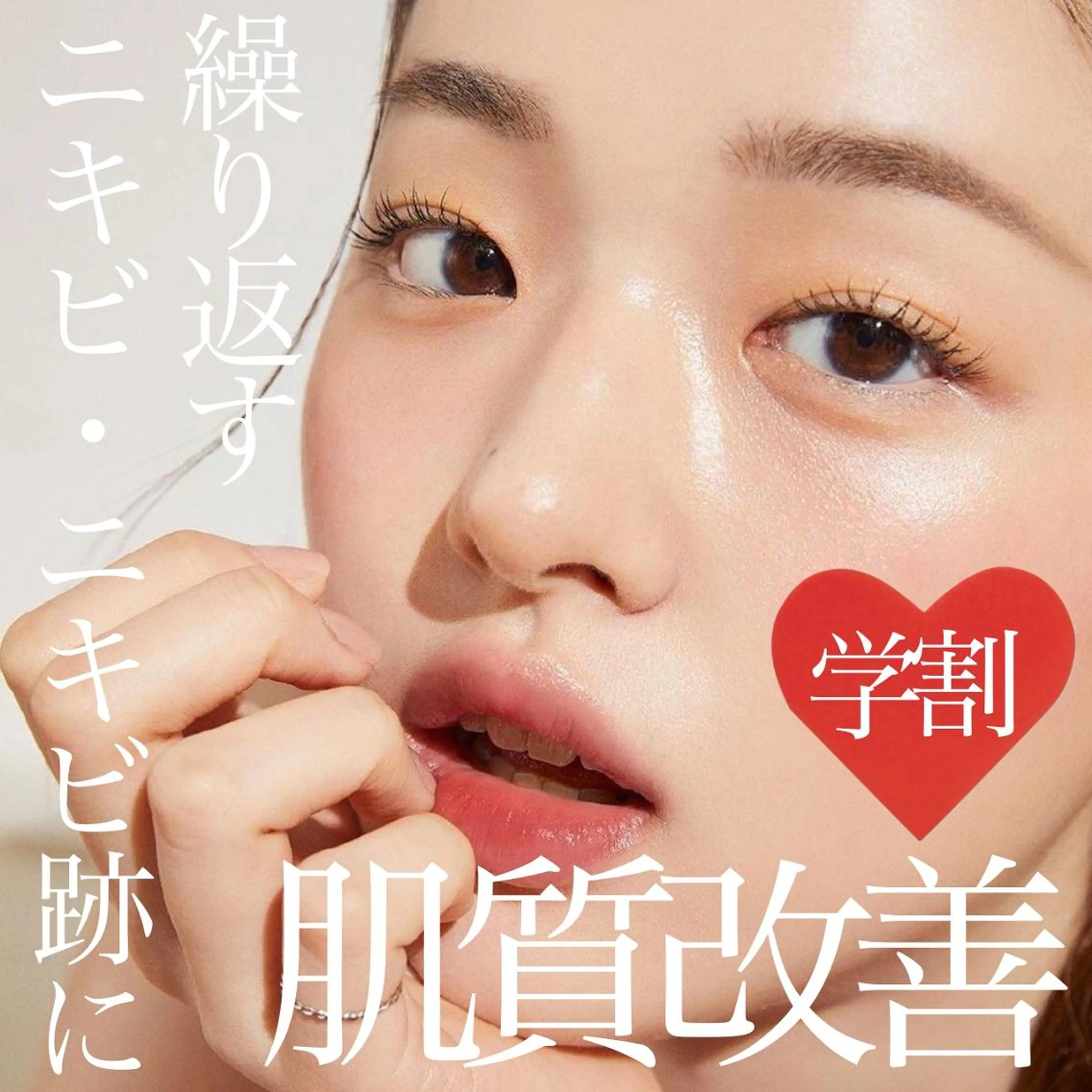 【ミニモ学割U24🏫】ニキビ肌にお悩みの方へ ニキビ・ニキビ跡解消 フォトRF  ¥2,980の写真