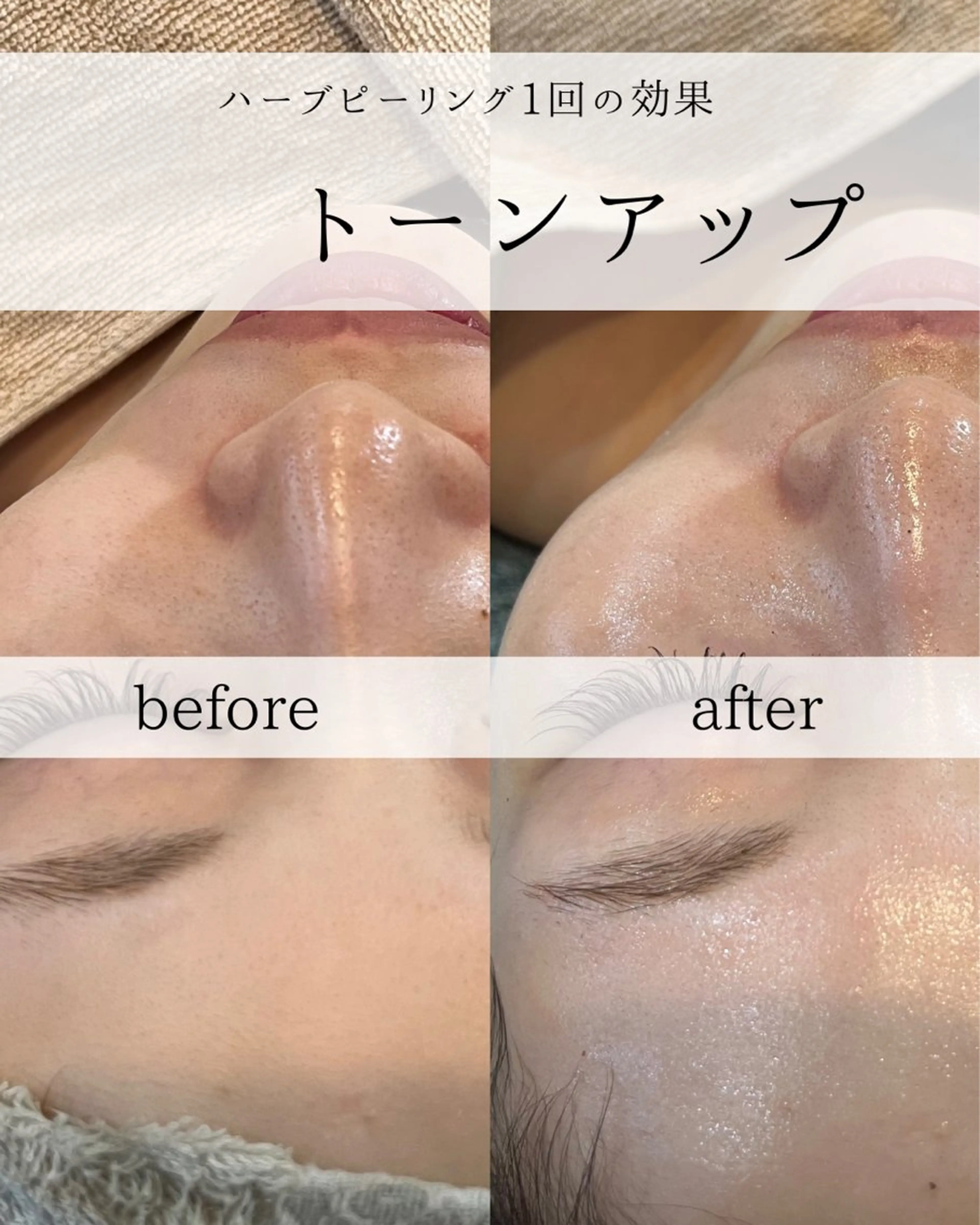 yc.hacci 【ハーブピーリング】の眉毛・アイブロウイメージ