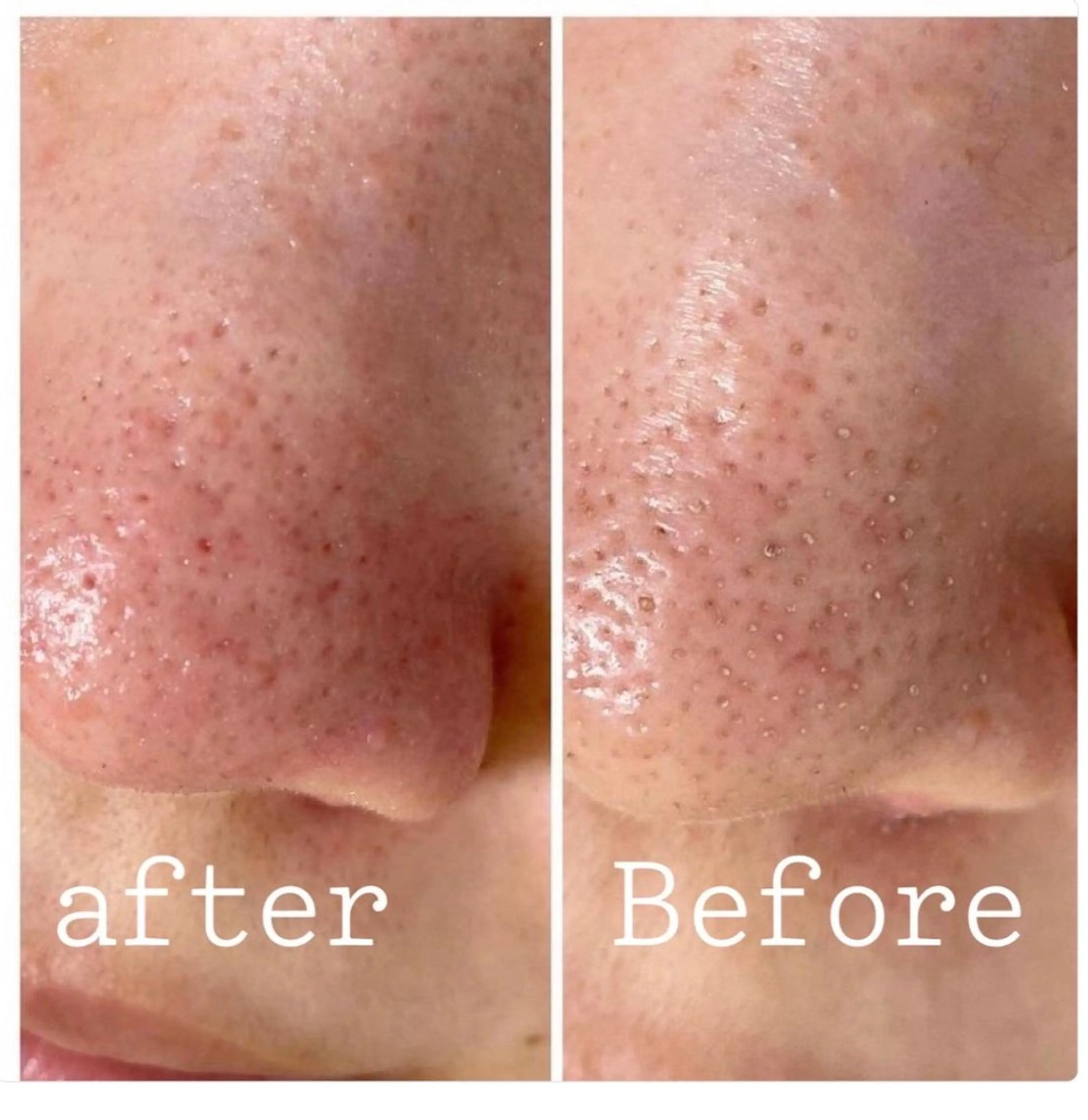 都度払い肌改善専門店 店長二上文香のエステ・リラクイメージ