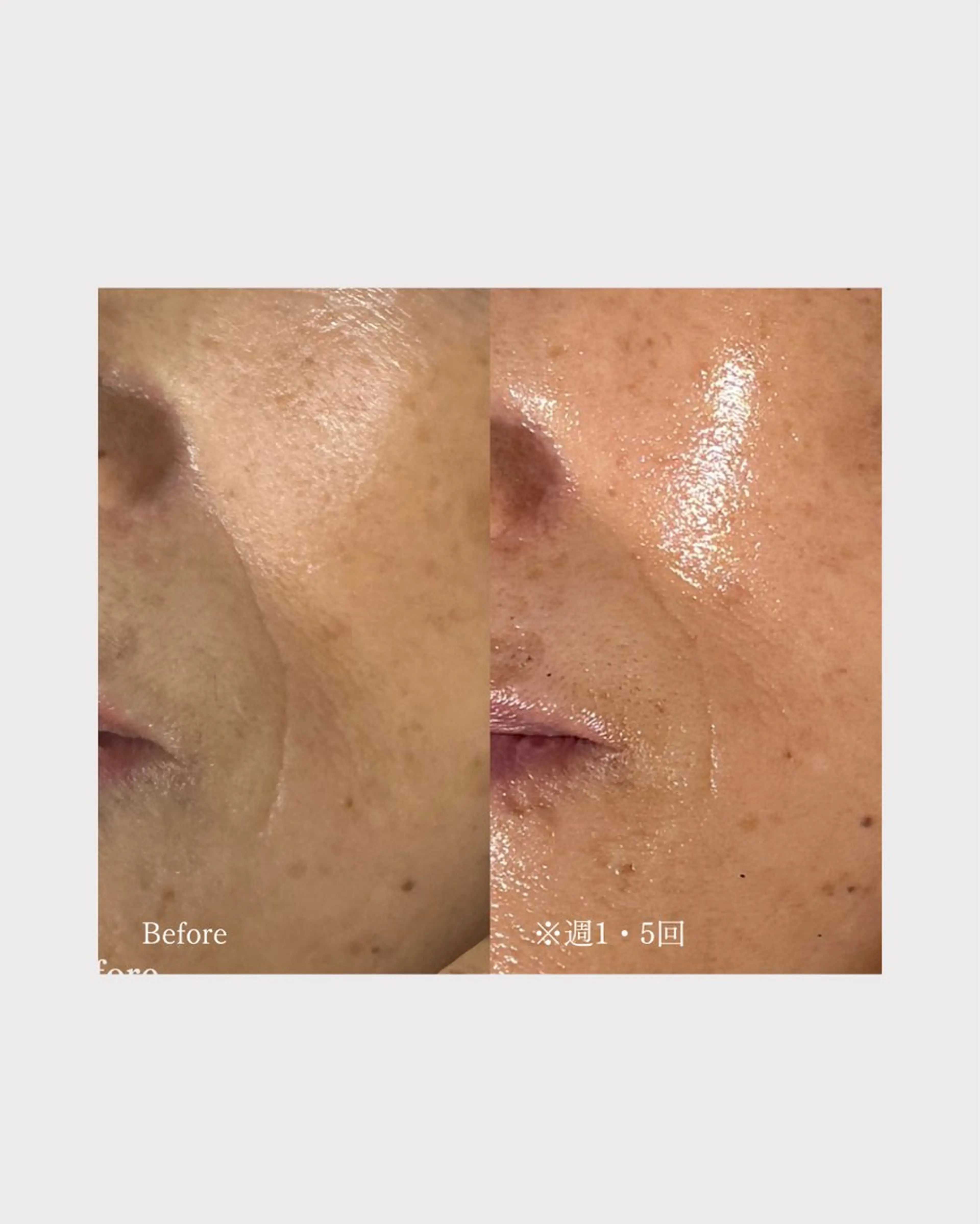 肌管理フェイシャル Utoutoのエステ・リラクイメージ