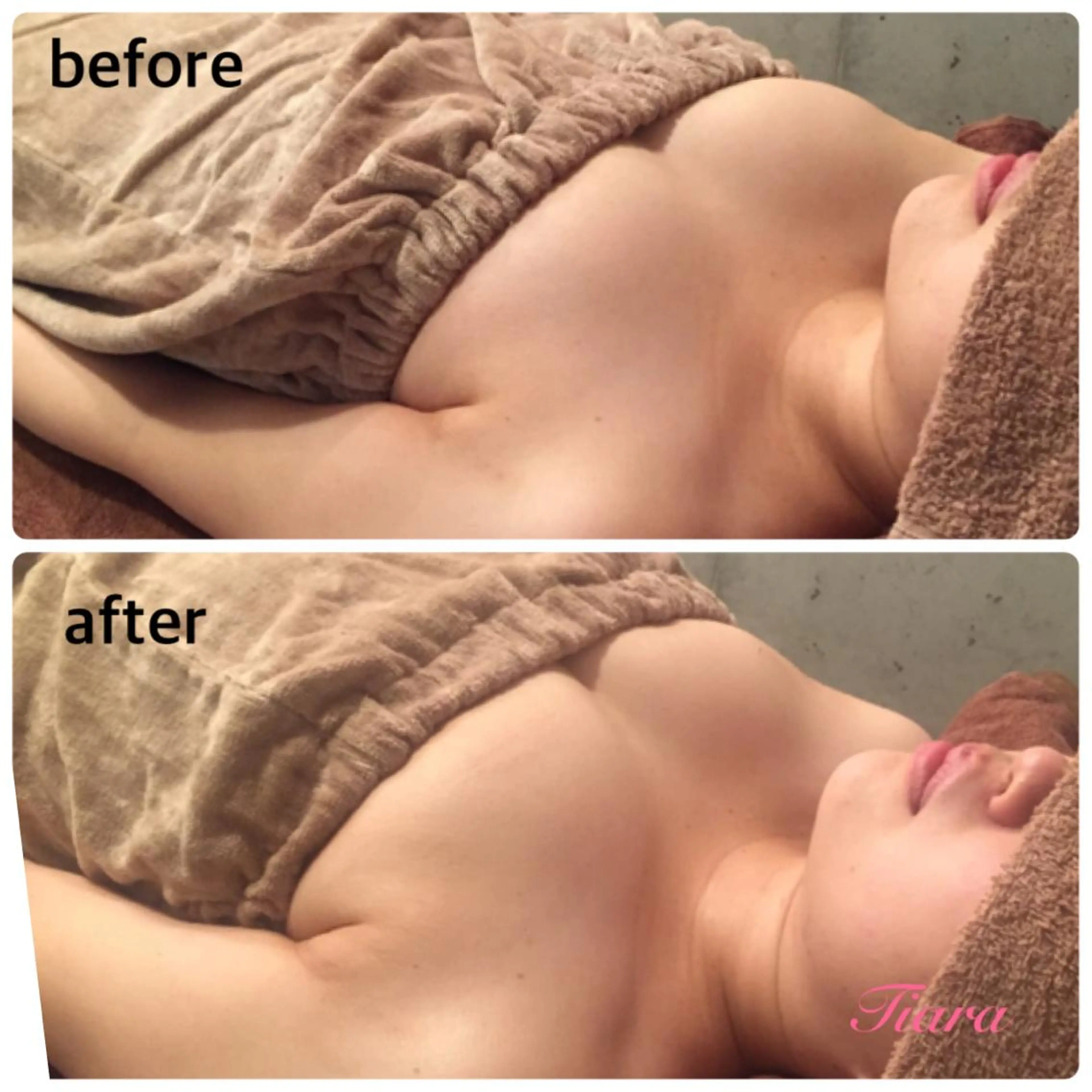 Tiara所属・冨樫 倫子のエステ・リラクイメージ