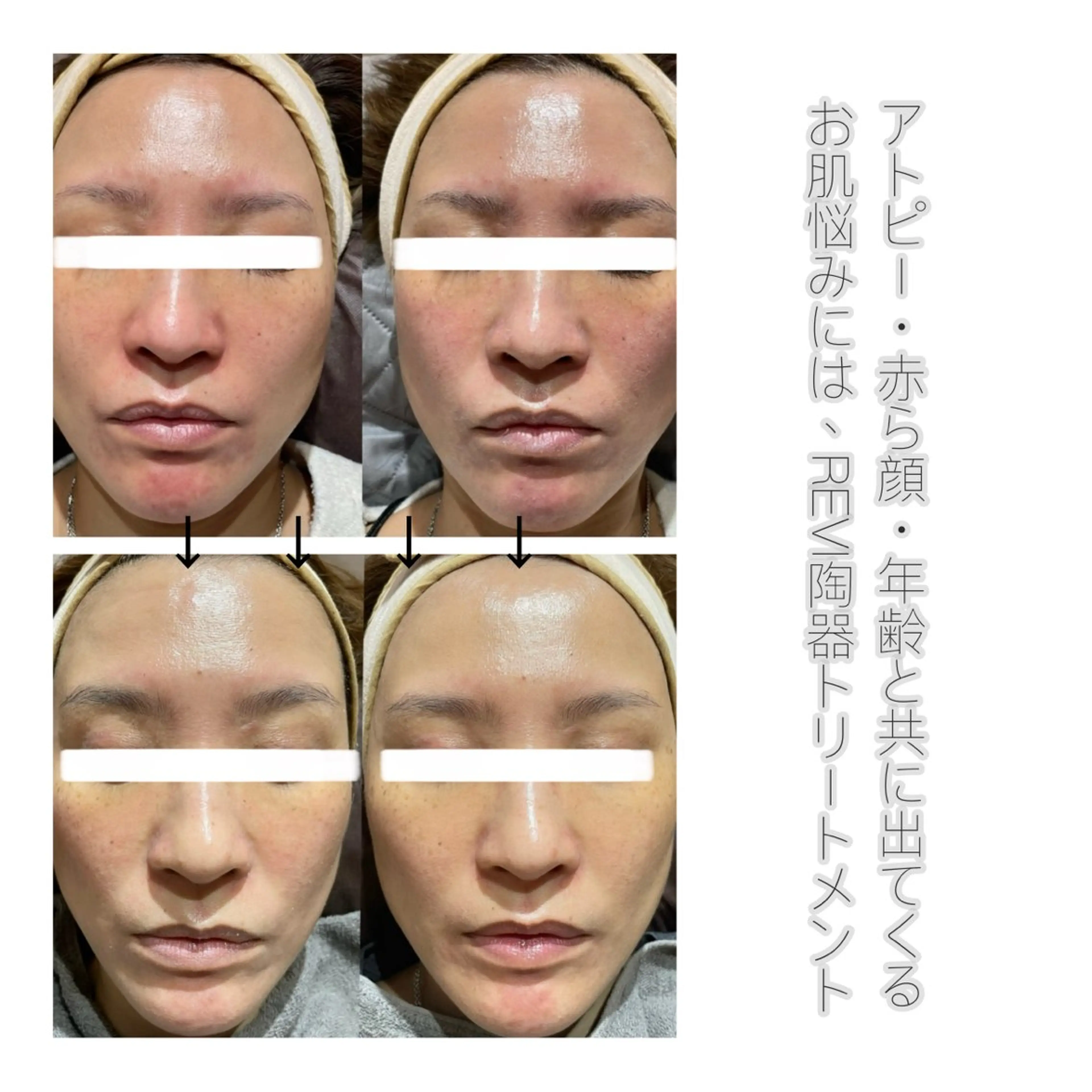 im所属・nagasawa asukaのネイルデザイン